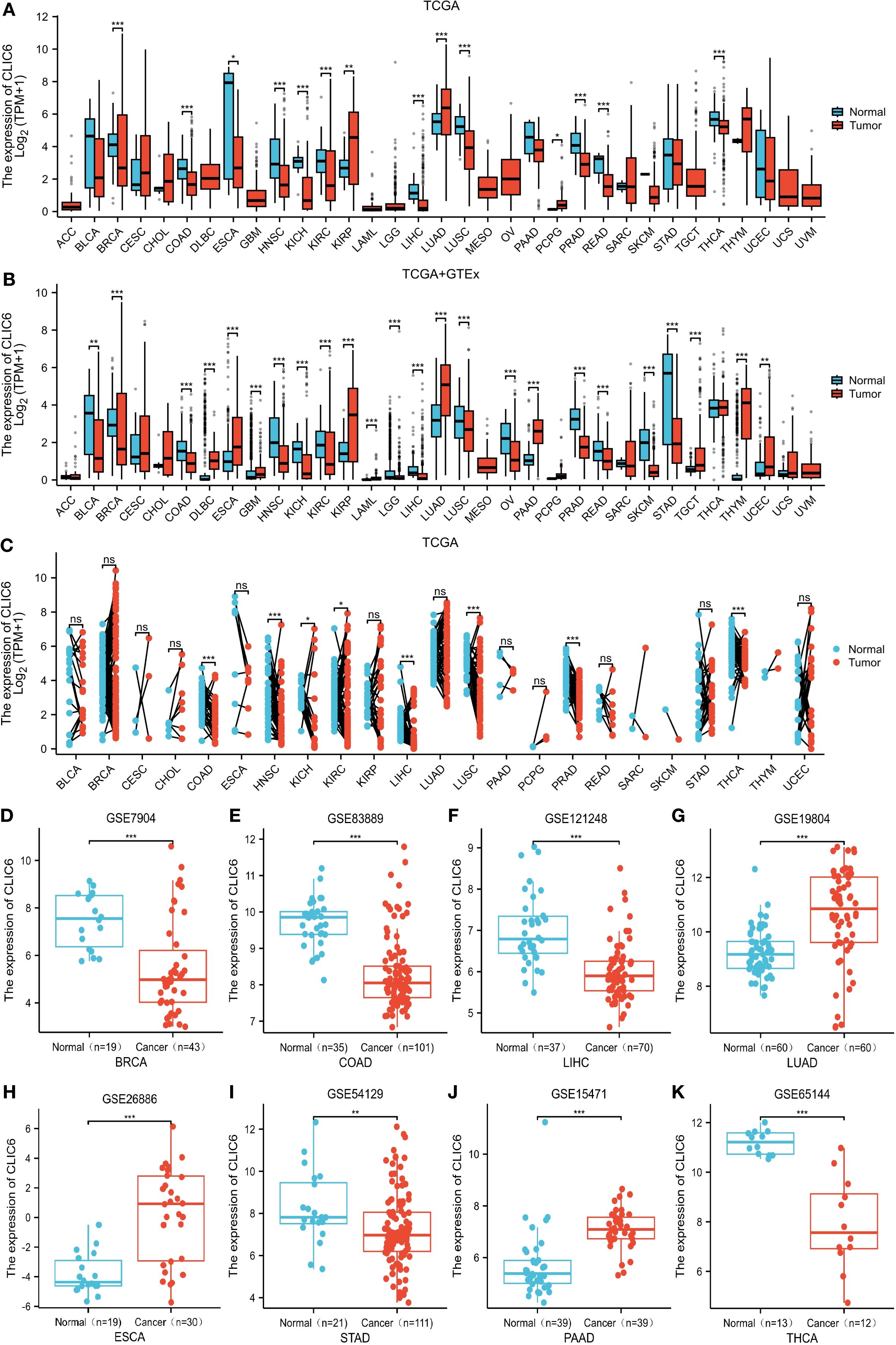 Box plots and scatter plots compare CLIC6 expression between normal and tumor tissue across various cancer types. Panels A and B show box plots for TCGA and TCGA+GTEx datasets, respectively. Panel C is a paired scatter plot for TCGA. Panels D to K display expression in other datasets, including GSE7904, GSE83889, GSE121248, GSE19804, GSE26886, GSE54129, GSE15471, and GSE65144. Statistical significance is denoted by asterisks, and colors indicate normal (blue) and tumor (red) samples.