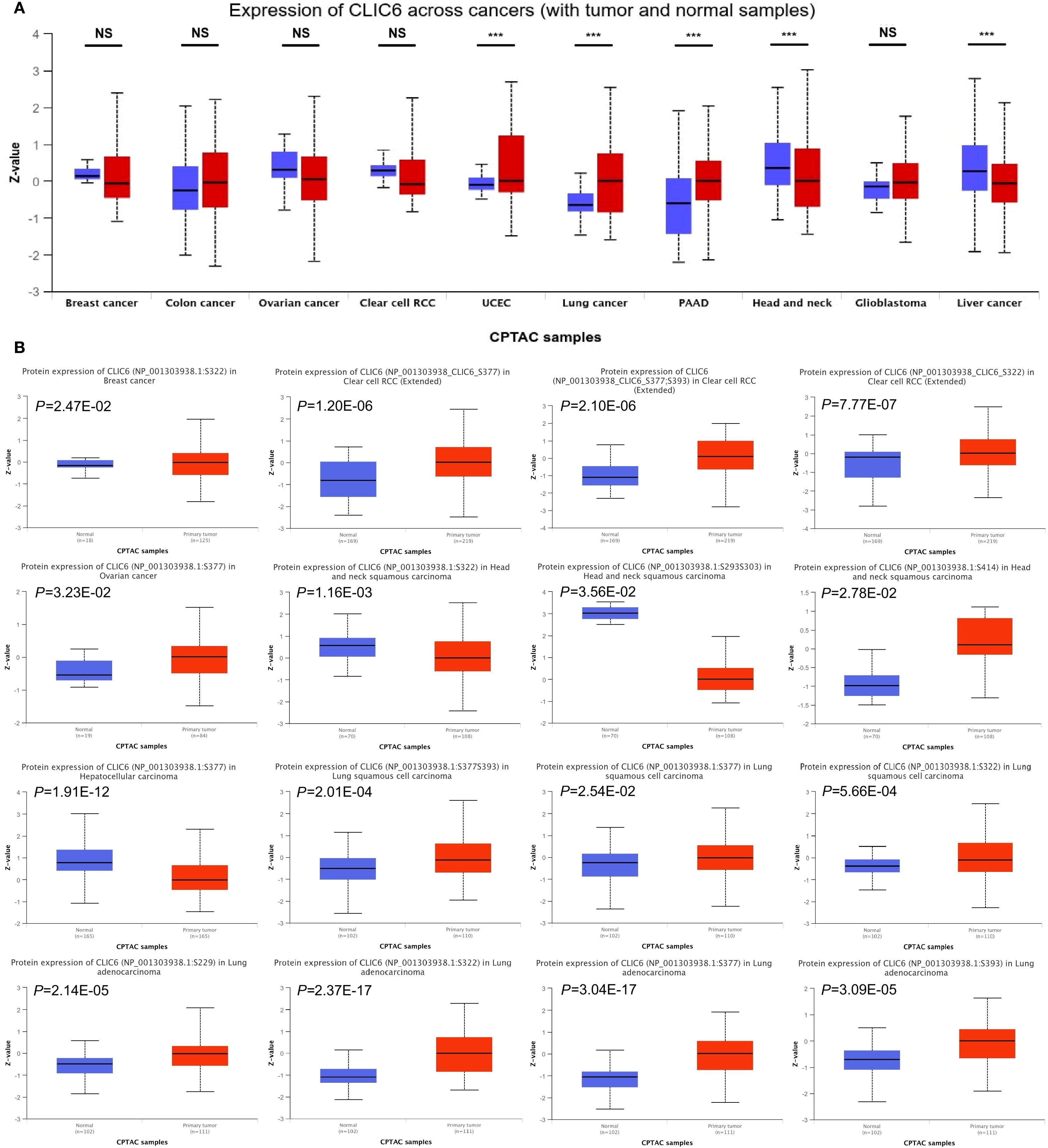 Box plots showing CLIC6 expression levels across various cancers in tumor (red) and normal (blue) samples. Part A displays significant differences, marked by asterisks, in cancers such as lung, head and neck, and glioblastoma. Part B presents protein expression data in CPTAC samples, with each plot indicating statistical significance through p-values. Tumor samples generally show higher expression levels across cancers like lung adenocarcinoma and liver cancer.