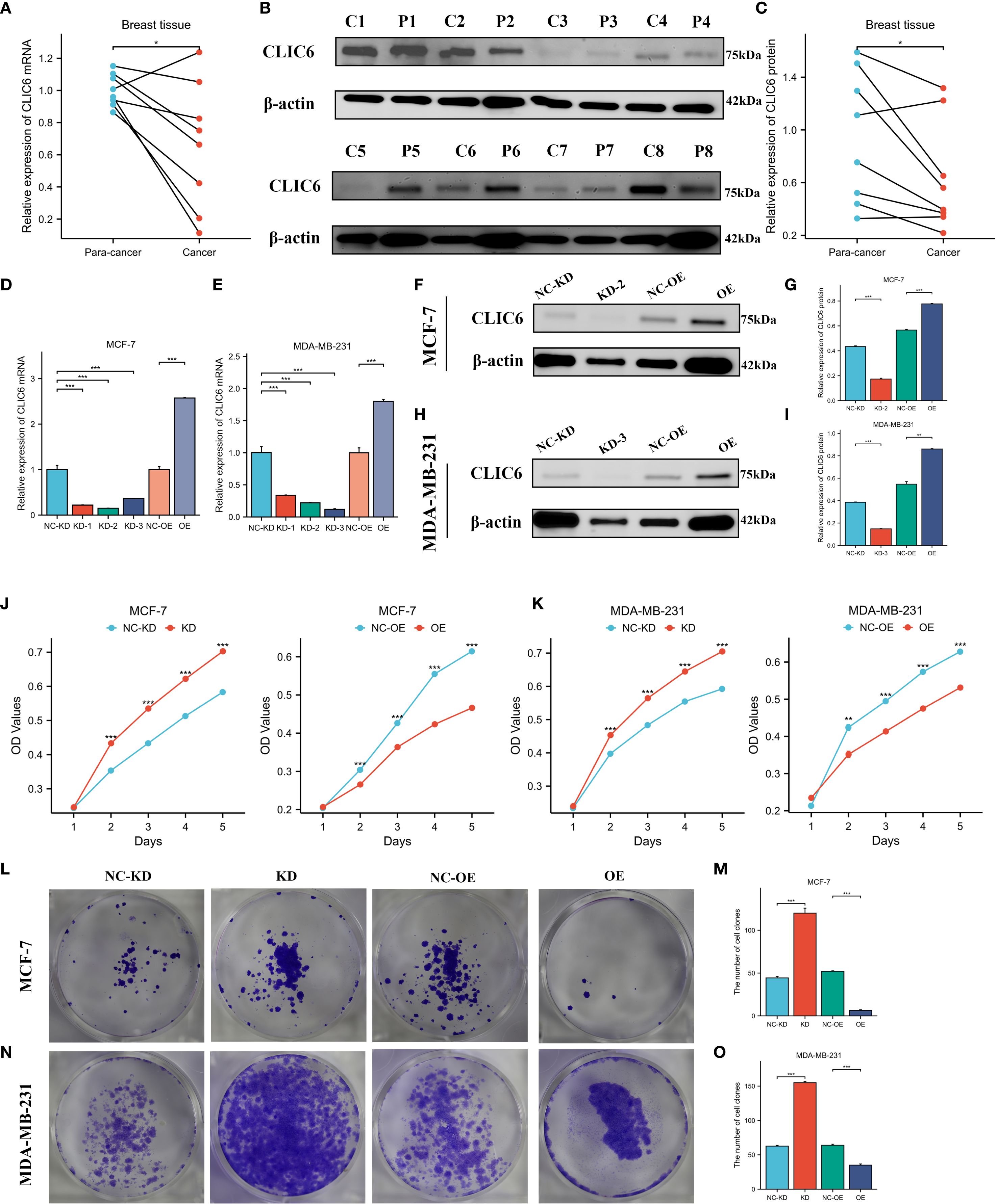 The image contains multiple panels illustrating experimental data related to CLIC6 expression in breast cancer. Panels A and C show line graphs comparing CLIC6 mRNA and protein expression in para-cancer and cancer tissues. Panel B displays western blot analysis results. Panels D and E show bar graphs of CLIC6 mRNA levels in MCF-7 and MDA-MB-231 cells under various conditions. Panels F and H present western blot images for MCF-7 and MDA-MB-231 cells. Panels G and I include bar graphs of relative CLIC6 protein levels. Panels J and K feature growth curves. Panels L and N display colony formation assays. Panels M and O depict bar graphs of colony numbers.