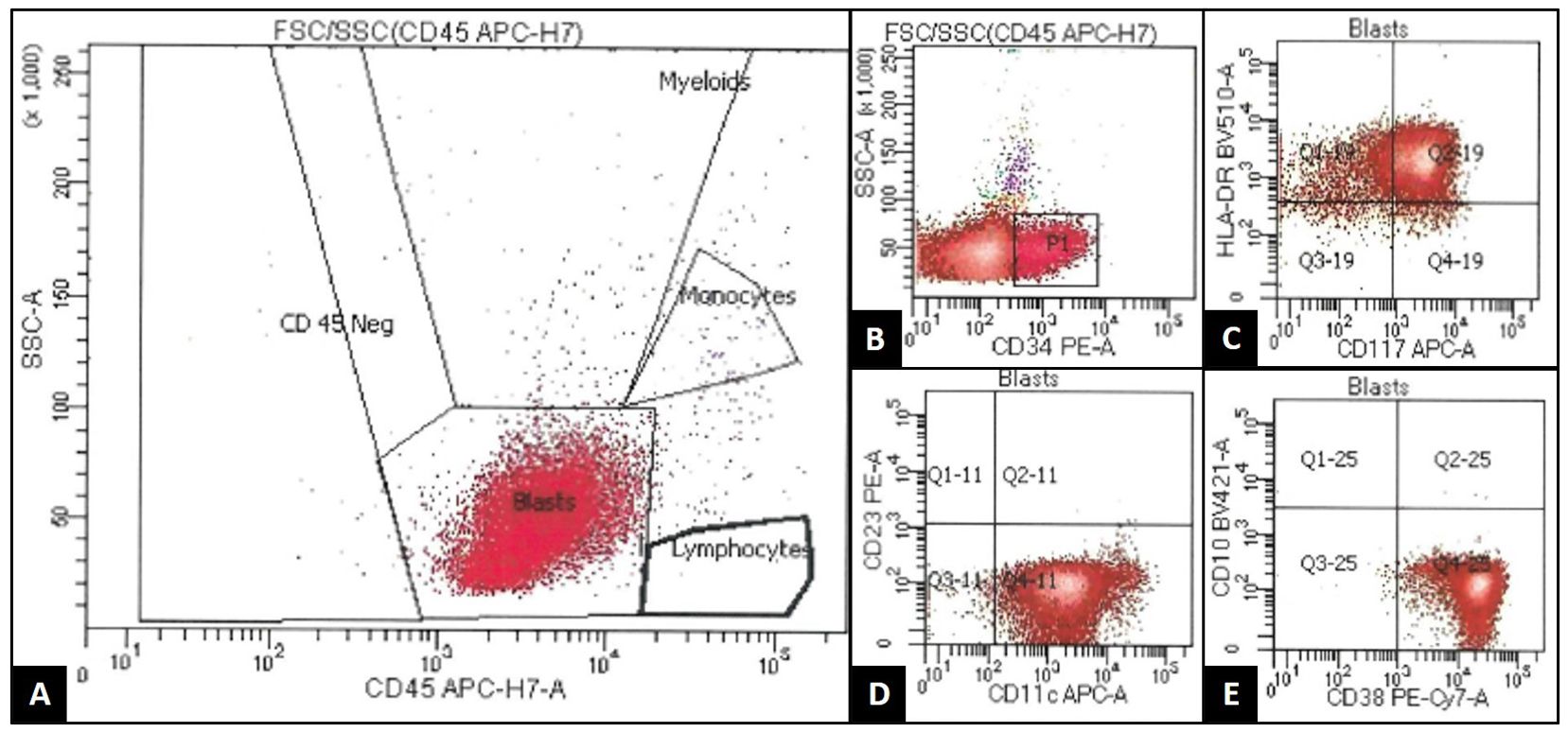 Flow cytometry scatter plots in panels labeled A to E. Panel A shows differentiation of cell populations (myeloids, lymphocytes, monocytes, and blasts) based on CD45 APC-H7. Panel B highlights CD34 PE-A expression in blasts. Panel C plots blasts with CD117 APC-A and HLA-DR BV510-A. Panel D displays CD23 PE-A and CD11c APC-A in blasts. Panel E illustrates CD10 BV421-A and CD38 PE-Cy7-A expression in blasts. Each panel visualizes cellular distribution via variations in color intensity, denoting cell concentration.