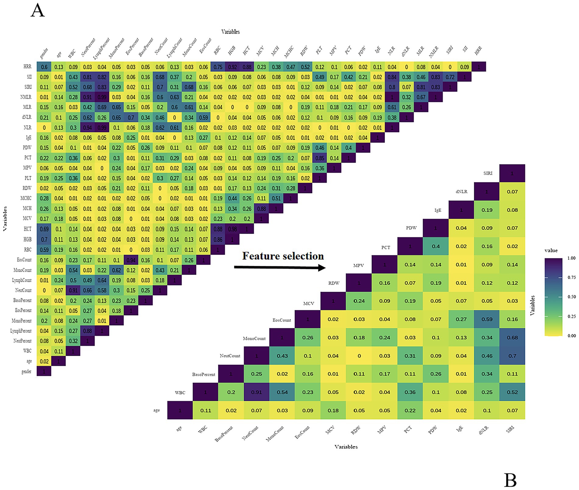 Correlation matrix depicting feature selection for two sets of variables labeled A and B. The upper triangular matrix (A) includes variables like HR, SH2, HGB, and others. The lower triangular matrix (B) features variables such as WBC, MCV, and IgE. Values range from dark blue, representing higher correlations (up to 1.0), to dark purple, representing lower correlations (0.0). An arrow labeled