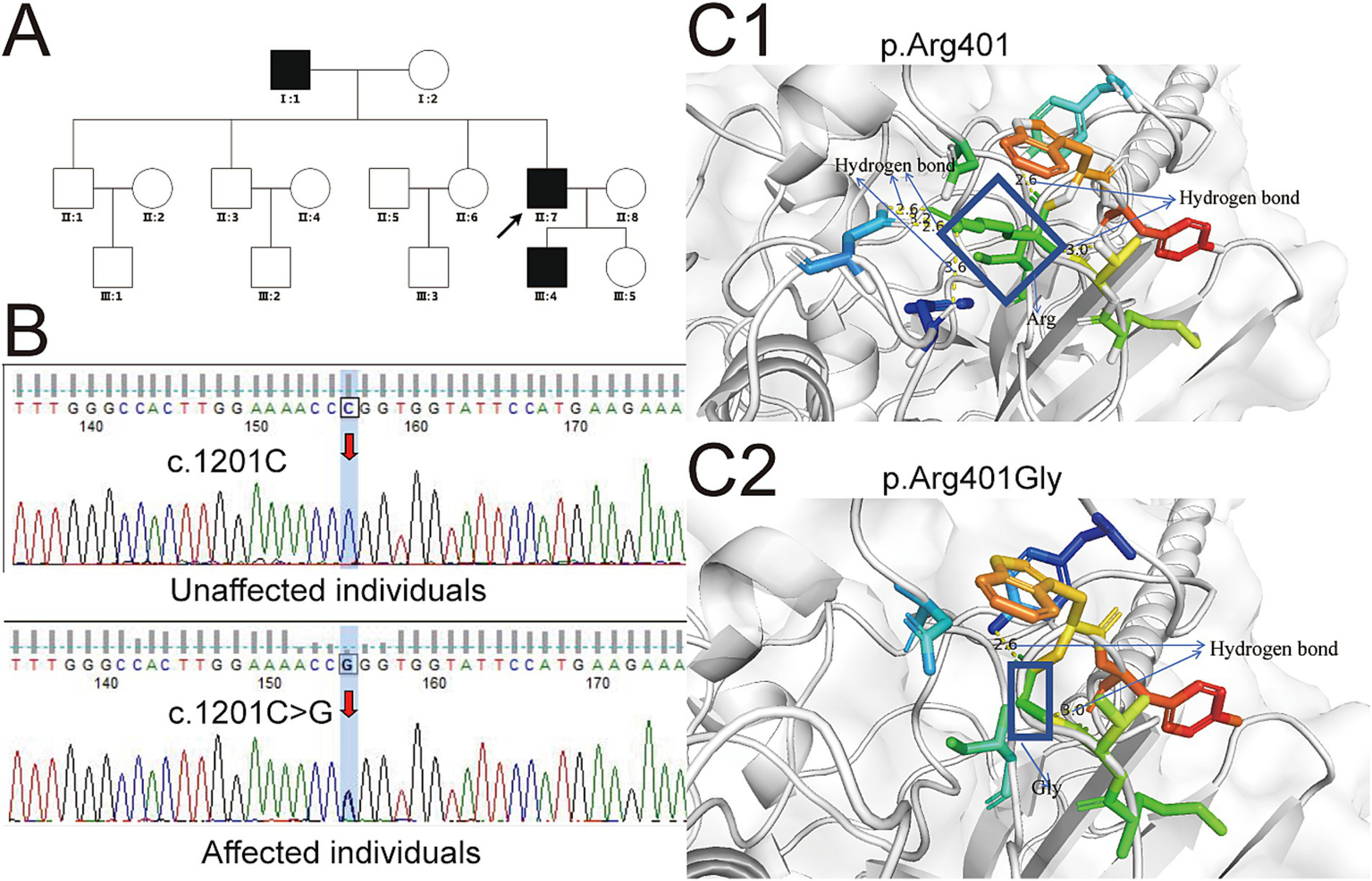 Diagram showing a genetic analysis. Panel A illustrates a family pedigree with affected individuals shaded in black. Panel B displays DNA sequencing chromatograms; one for an unaffected individual with nucleotide sequence c.1201C and another for an affected individual showing a c.1201C>G mutation. Panels C1 and C2 depict 3D protein structures. C1 shows the structure with arginine at position 401 and hydrogen bonds, while C2 depicts the altered structure where arginine is replaced by glycine at the same position, along with the hydrogen bonds involved.