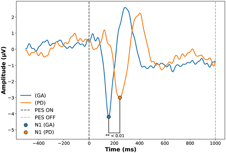 Line graph depicting amplitude in microvolts (µV) over time in milliseconds (ms) for two conditions: GA (blue line) and PD (orange line). Vertical dashed lines indicate PES ON and PES OFF timings. Notable points labeled N1 (GA) and N1 (PD) show a significant difference at less than 0.01.