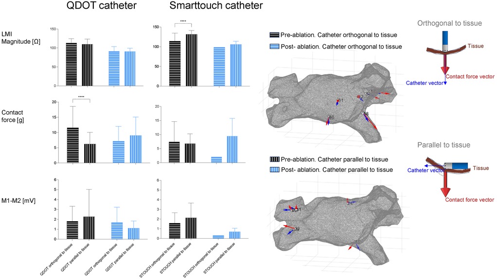 Bar charts and diagrams compare QDOT and Smarttouch catheters. Charts show LMI Magnitude, Contact Force, and M1-M2 for different tissue alignment scenarios. Illustrations depict catheter vectors orthogonal and parallel to tissue with contact force vectors, highlighting pre- and post-ablation differences.