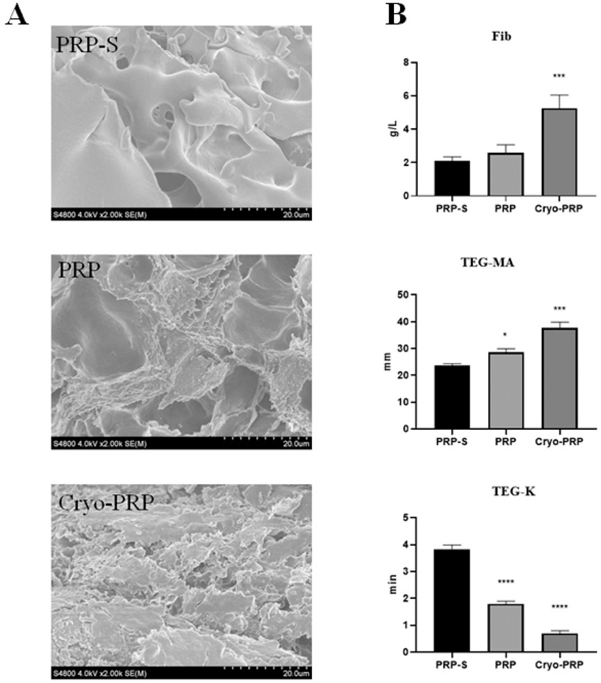 Panel A shows SEM images of PRP-S, PRP, and Cryo-PRP, depicting varying surface textures at a scale of 20 micrometers. Panel B presents three bar graphs: Fib, TEG-MA, and TEG-K. Each graph compares PRP-S, PRP, and Cryo-PRP. In Fib and TEG-MA, Cryo-PRP shows the highest increase, marked by asterisks indicating statistical significance. TEG-K shows PRP-S with the highest value.