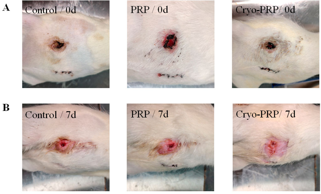 Series of images showing wound healing in three different treatments: Control, PRP, and Cryo-PRP. Panel A shows wounds at day zero, with notable differences in tissue appearance among the treatments. Panel B shows wounds at day seven, where healing progression is visible, with varied wound closure and tissue regeneration across the treatments.