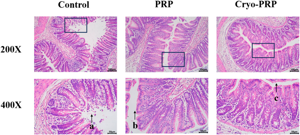 Microscopic images show intestinal tissue sections at 200X and 400X magnifications under three conditions: Control, PRP, and Cryo-PRP. The sections highlight tissue morphology with purple and pink staining. Labeled arrows indicate specific features within the 400X images. Comparison suggests structural differences among the three conditions.