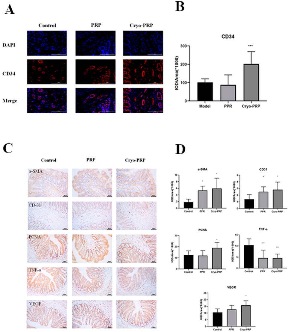 Panel A shows fluorescence microscopy images with three treatments: control, PRP, and Cryo-PRP, highlighting DAPI (blue) and CD34 (red) staining with merged images. Panel B is a bar graph presenting CD34 expression levels, showing higher expression in Cryo-PRP. Panel C displays immunohistochemistry images for α-SMA, CD31, PCNA, TNF-α, and VEGF under the same treatments. Panel D contains bar graphs showing quantitative analysis of these markers, with Cryo-PRP generally enhancing expression levels compared to the control and PRP.