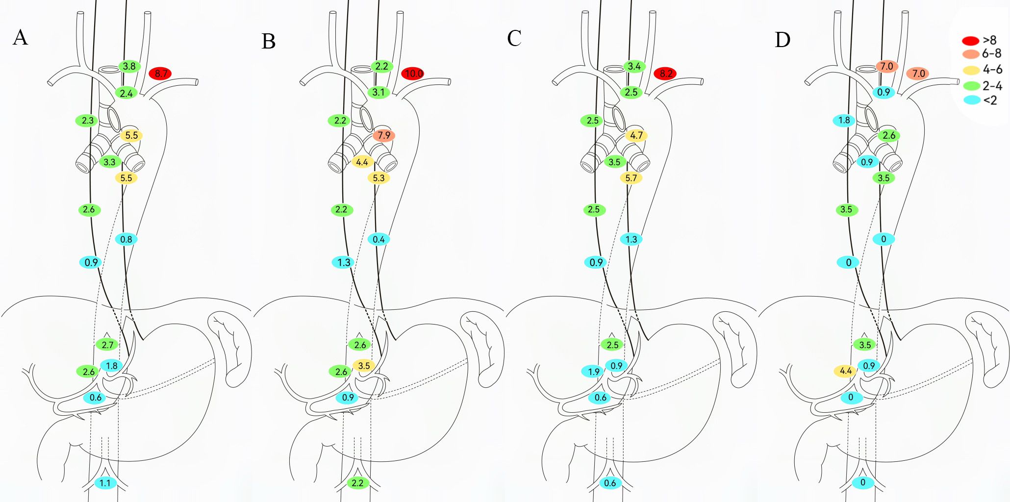 Diagrams A through D show anatomical diagrams of the lymph node metastasis rate with different types of neoadjuvant therapy. In each panel, the regions are color-coded: red indicates lymph node metastasis greater than 8%, orange indicates a metastasis rate of 6% to 8%, yellow indicates a metastasis rate of 4% to 6%, green indicates a metastasis rate of 2% to 4%, and blue indicates a metastasis rate of less than 2%. Each region is shown with a corresponding numerical value, indicating the specific lymph node metastasis rate within the anatomy.