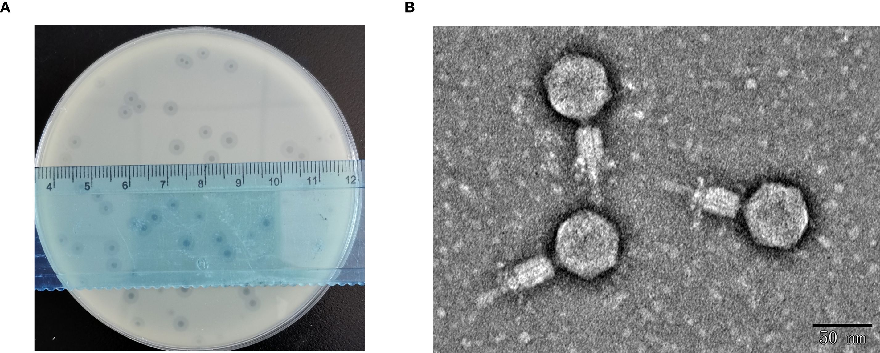 Panel A shows a petri dish with bacterial colonies, each forming small clear zones, and a ruler for scale. Panel B displays three bacteriophages observed under a high-resolution microscope, featuring distinct capsid heads and tail structures.