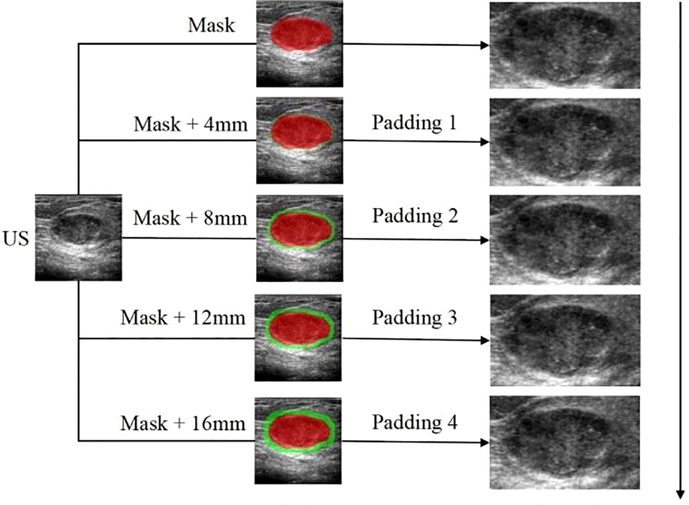 Ultrasound image flowchart showing a progression from a base ultrasound (US) image through several stages: Mask, Mask plus four millimeters, Mask plus eight millimeters, Mask plus twelve millimeters, and Mask plus sixteen millimeters. Each stage highlights a red area with green outlines, increasing in padding from zero to four. The final column displays the resulting ultrasound images corresponding to each padding level.