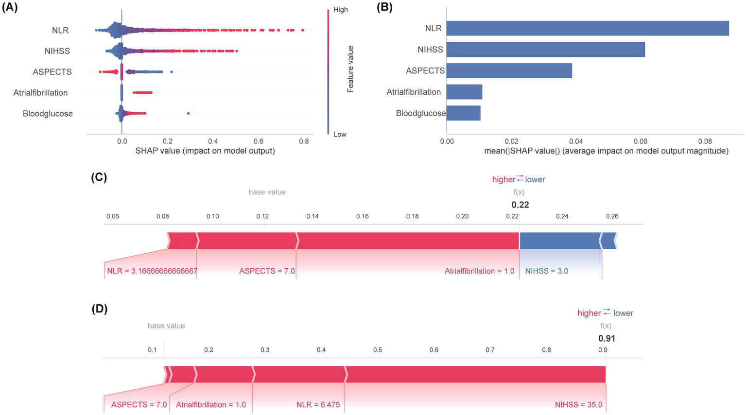 The image contains four subfigures labeled A, B, C, and D. Subfigure A displays a violin plot with SHAP values indicating the impact of features like NLR, NIHSS, ASPECTS, Atrialfibrillation, and Bloodglucose on model output, with color-coding for feature value magnitude. Subfigure B shows a bar chart of mean SHAP values, highlighting the average impact of these features on the model. Subfigures C and D are waterfall plots illustrating the contribution of specific feature values to a model prediction, showcasing higher and lower influence.