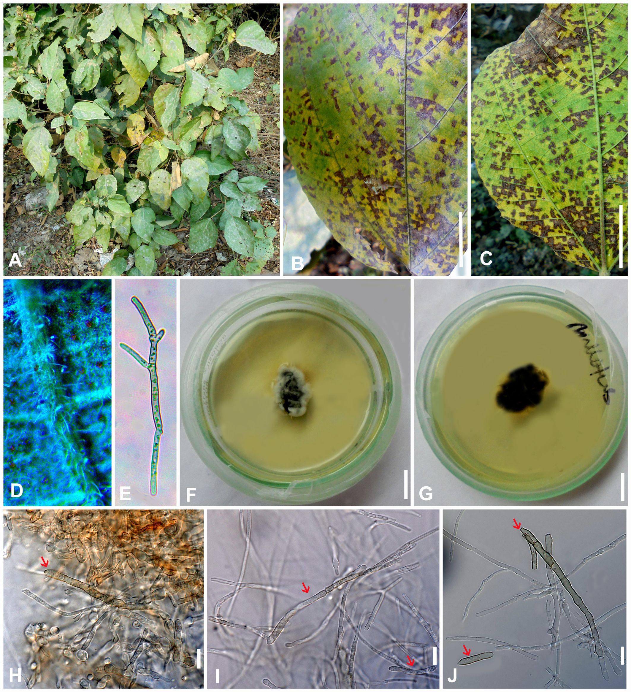 Composite image showing: A) A plant with discolored leaves. B) Close-up of a leaf with purple-brown spots. C) Another leaf with similar spotting. D) Microscopic view of a leaf surface with fungal structures. E) Hyphae viewed under a microscope. F and G) Two petri dishes with fungal cultures. H) Microscopic view showing fungal growth on plant material. I and J) Detailed view of fungal structures, with arrows indicating specific features.