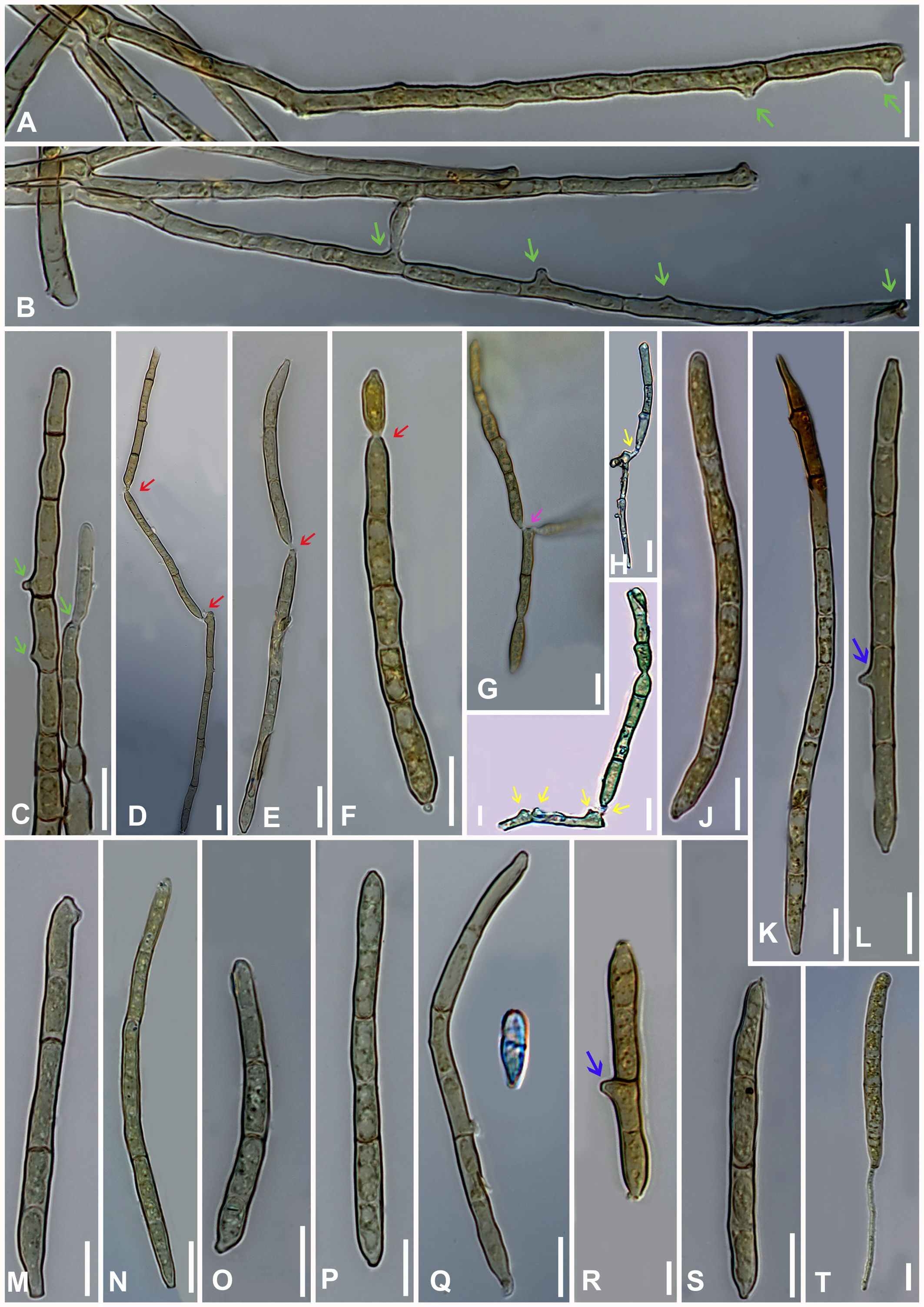 Microscopic images of filamentous structures, likely algae or fungi, shown in various stages and angles. Each panel from A to T displays different formations, with visible cell divisions and colored arrows indicating points of interest. The filaments are mostly brown and green, appearing segmented, with some showing branching or budding.