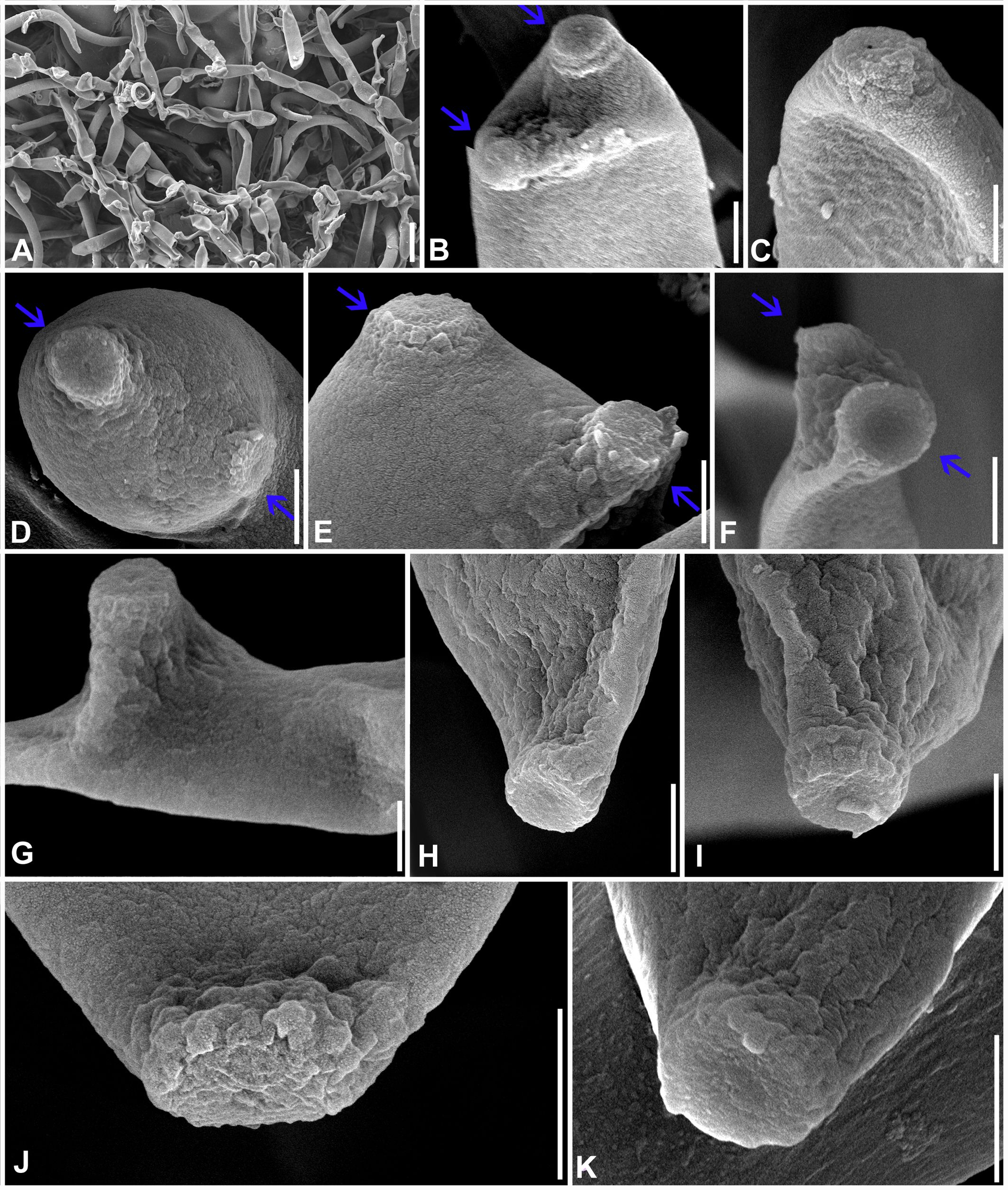 Microscopic images of varying fungal structures labeled A to K. A shows a dense network of hyphae. B through K display close-ups of different fungal features, including spore-like formations and varied surface textures. Arrows highlight specific structures or textures in some images. Each section provides distinct details with a consistent black and white color scheme.