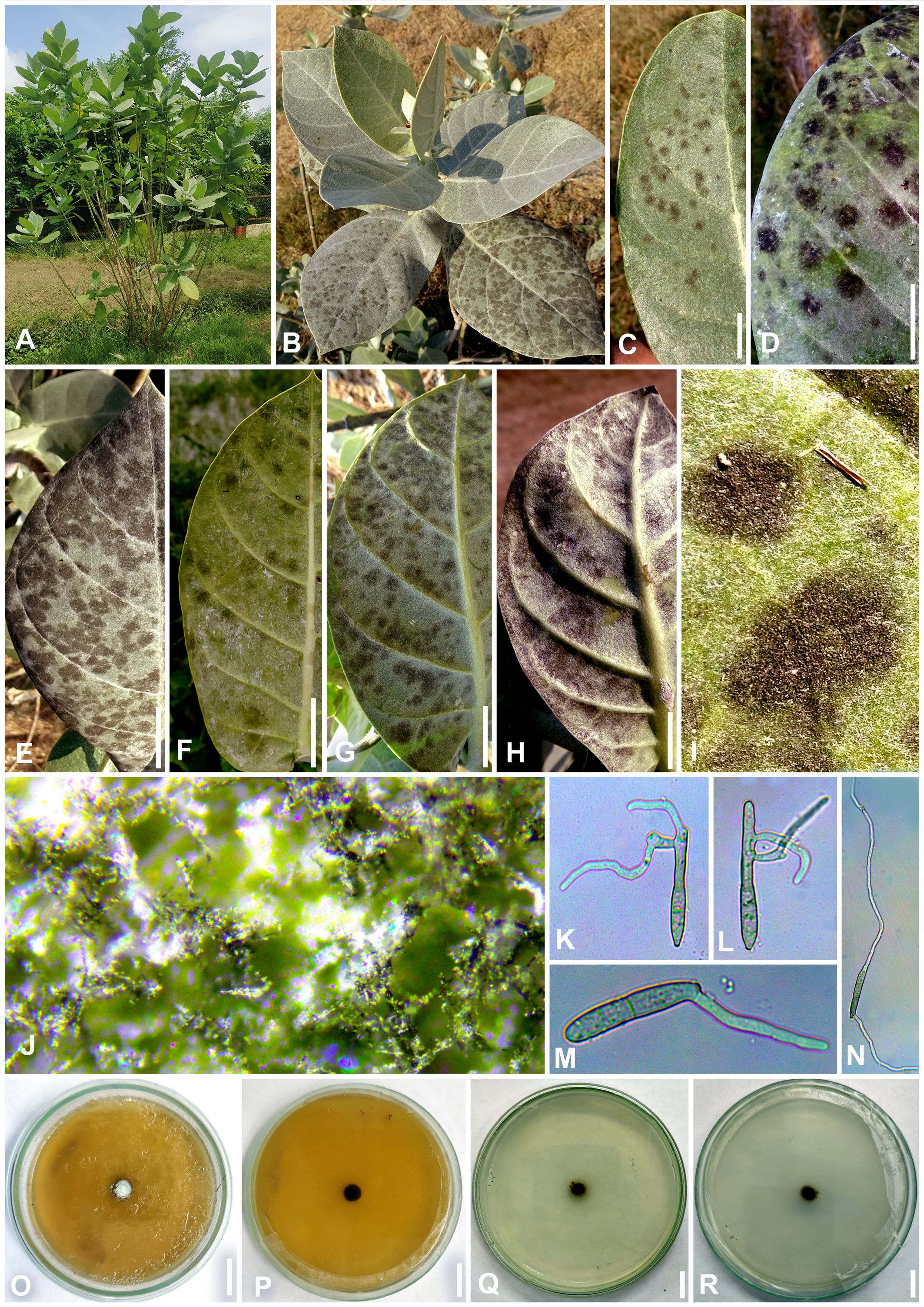 A plant with multiple images showing leaf spot symptoms at various stages. Panels A-H depict leaves with brown-black spots. Panel I shows close-up of leaf surface detail. Panel J is a microscopic view of plant tissue. Panels K-N exhibit fungal structures under a microscope. Panels O-R display petri dishes with fungal cultures growing.