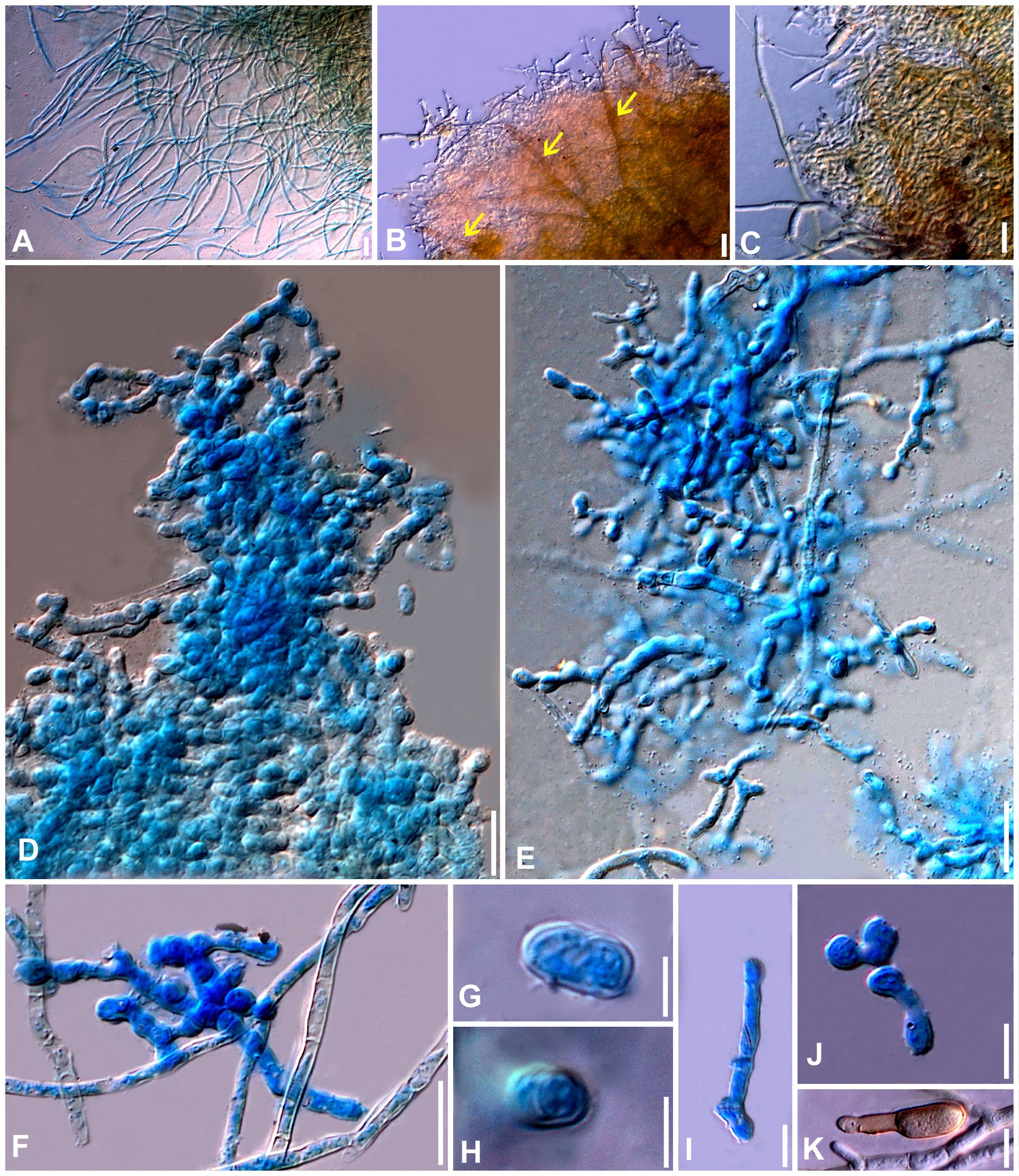 Microscopic images show various fungal structures. A: Long, thin, blue-stained filaments. B: Brownish growth with yellow arrows pointing to the branching patterns. C: Brown and blue-stained dense structures. D: Dense blue-stained cluster. E: Blue-stained branching network. F: Blue-stained round clusters on thin filaments. G: Elliptical structure under high magnification. H: Close-up of a round cell. I: Elongated blue-stained rod. J: Branching blue-stained structures. K: Brown-stained, long, elliptical shape. Each panel showcases distinct fungal characteristics and features.