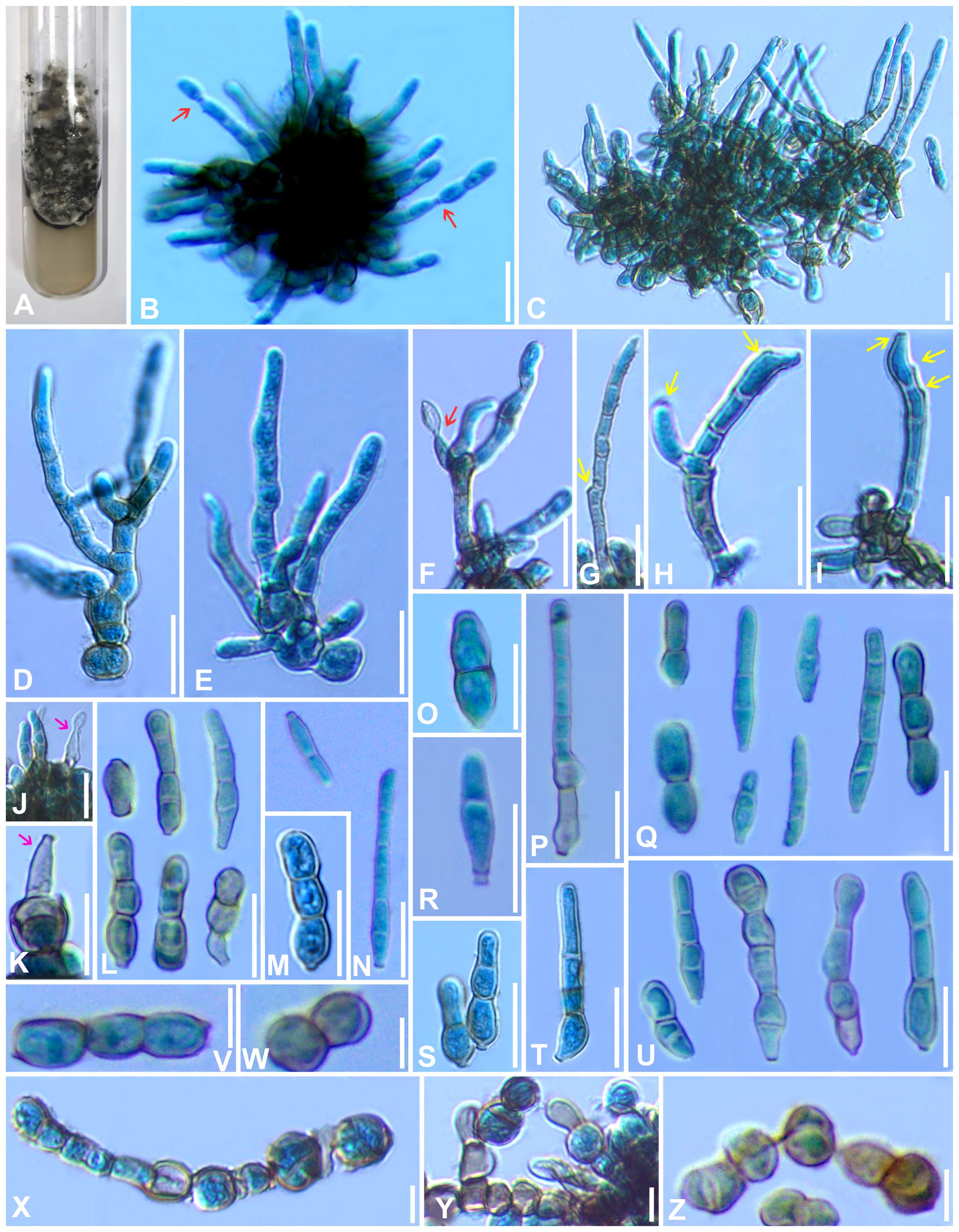 Composite image showing fungal structures. A: Fungal growth in a test tube. B-I: Microscopic views of hyphal structures with arrows indicating features. J-N: Close-ups of conidia and spores with arrows. O-Z: Various spore arrangements and magnifications, highlighting different shapes and segmentations. Each panel includes scale bars for reference.