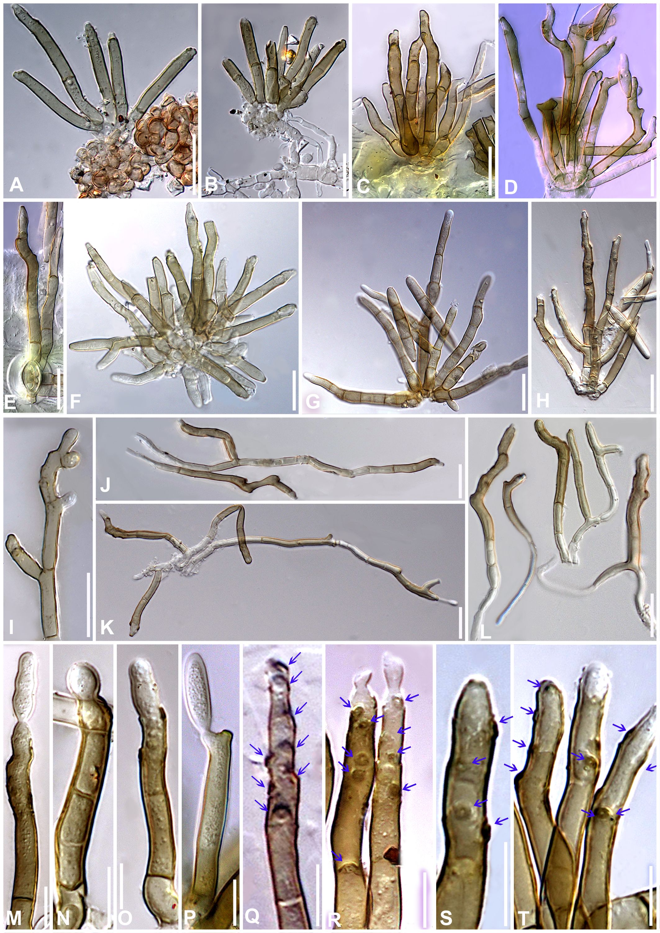 Microscopic images of fungal structures labeled A to T. Each panel shows different morphological features of fungal hyphae, including branching patterns and segmentations. Panels M to T highlight magnified views of hyphal tips and structures with annotations pointing to specific areas. The images display various levels of transparency and pigmentation, indicating structural differences and details significant for identification or study.