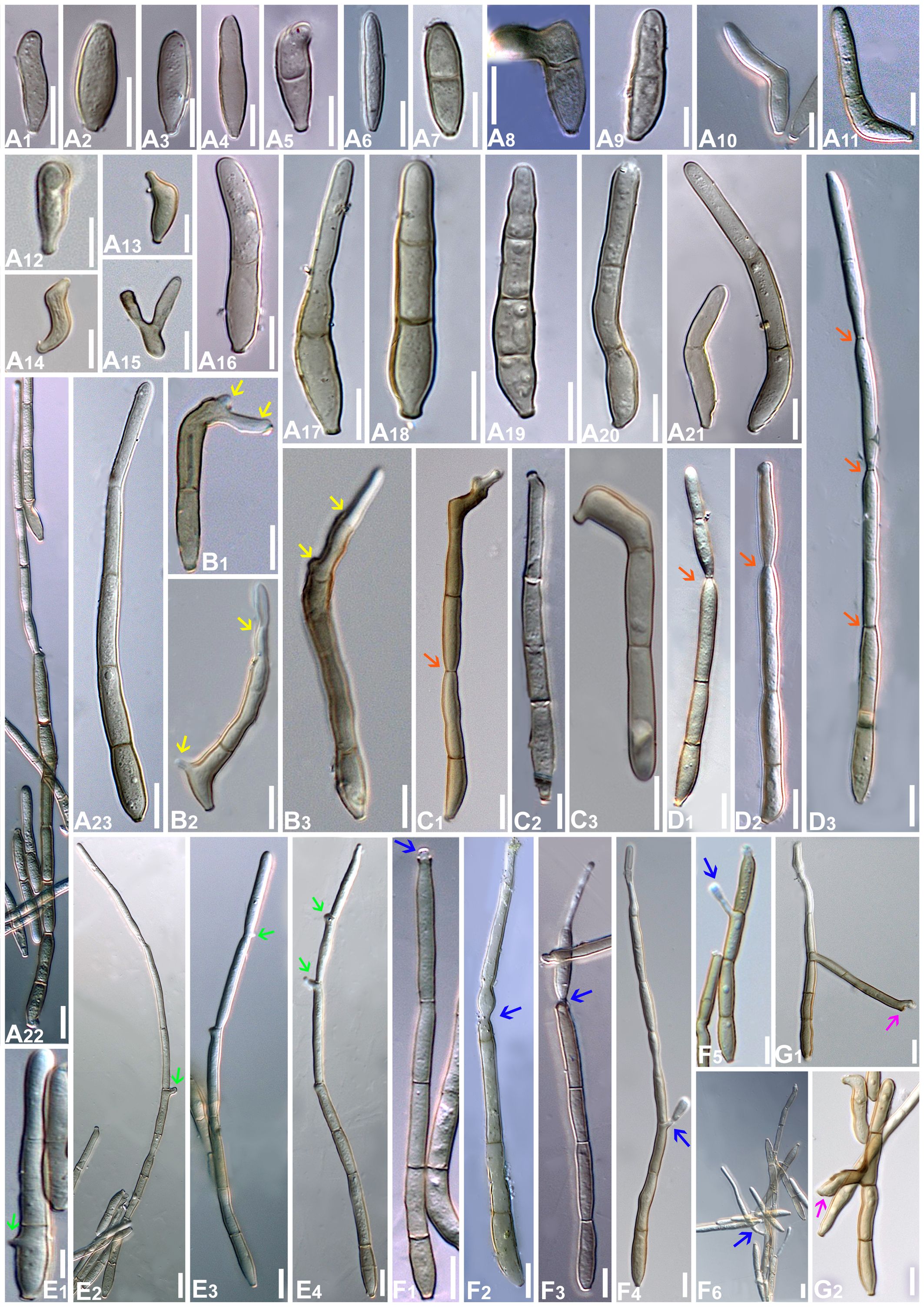 Microscopic images of various fungal structures, labeled A1 to G2. The images show different forms, sizes, and angles of hyphal cells, some with visible septa and differentiations. Arrows in yellow, orange, green, blue, and pink indicate specific points of interest, such as divisions or connections between cells. Each structure appears translucent with varying degrees of curvature and connectivity.