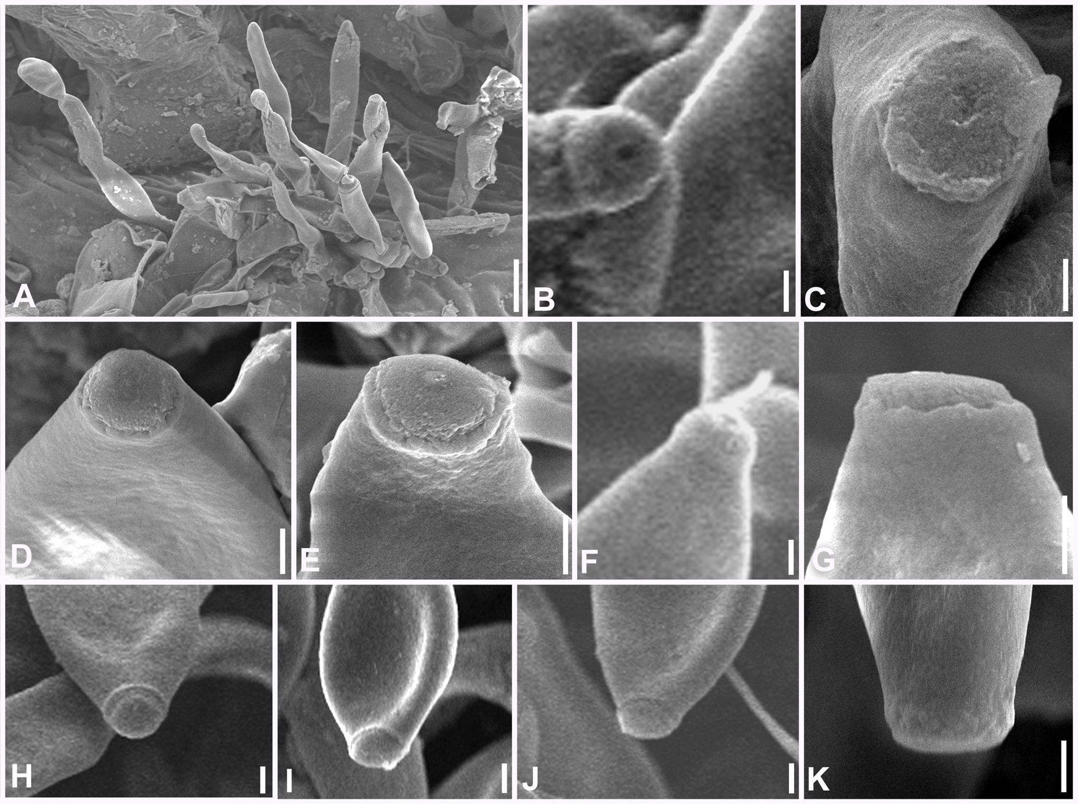 Scanning electron microscope images showing different fungal structures. Panel A depicts a cluster of elongated spore-producing structures. Panels B to K display various magnified views of spore tips, showcasing diverse shapes and surface textures. Each panel highlights the microstructural details of the fungal elements, with scale bars indicating magnification level.