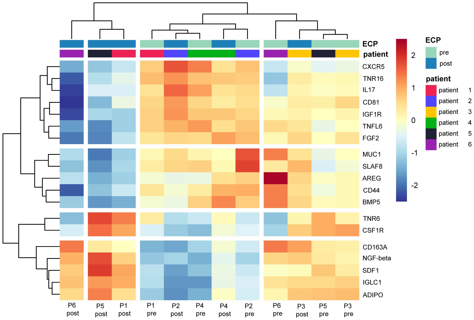 Clustered heatmap displaying the expression levels of various genes (e.g., CXCR5, TNR16) across different patients before and after a treatment (pre and post). The color scale ranges from blue to red, representing values from -2 to 2. The top legend differentiates between pre and post samples, while the side legend categorizes patient groups using various colors. Dendrograms indicate clustering of both genes and patient samples.