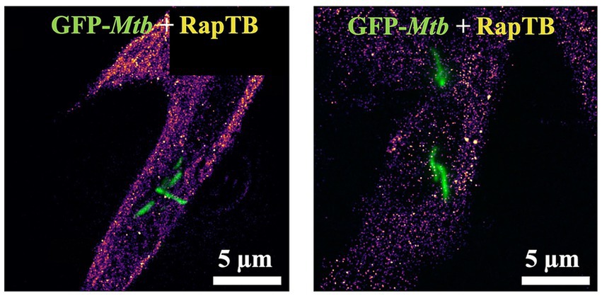 Fluorescence microscopy images show cells with GFP-tagged Mtb (green fluorescence) and RapTB presence (magenta). Two panels with GFP-Mtb exposed at different conditions demonstrate contrasting localization and distribution patterns. Scale bars indicate five micrometers.