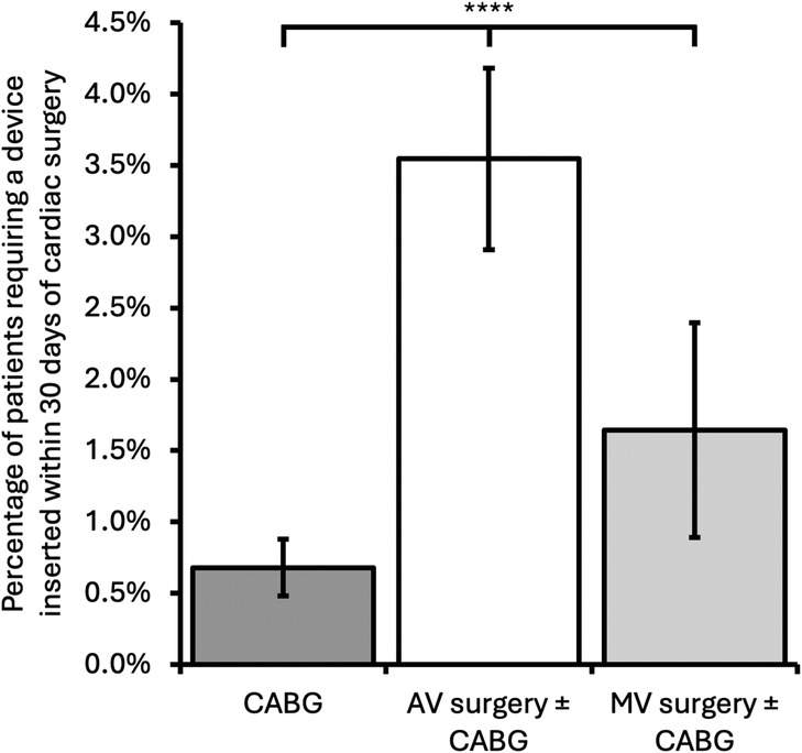 Bar graph showing percentages of patients requiring a device within thirty days post-cardiac surgery. CABG is below 1%, AV surgery with or without CABG is around 4%, and MV surgery with or without CABG is approximately 1.8%. Statistical significance is indicated between CABG and AV surgery with annotations for significance (****).