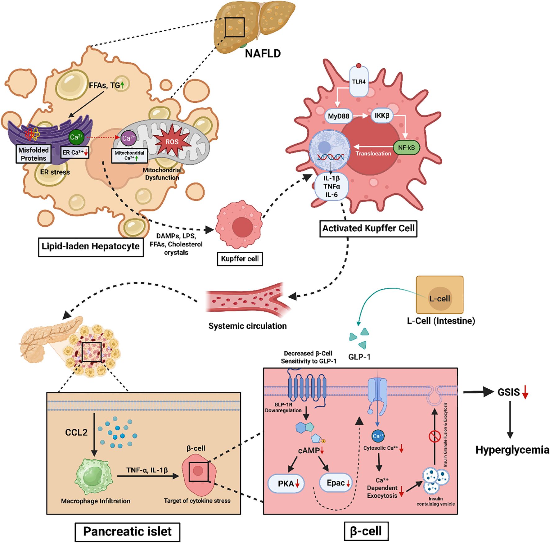 Diagram illustrating the pathway from non-alcoholic fatty liver disease (NAFLD) to hyperglycemia. It shows a lipid-laden hepatocyte with ER and mitochondrial dysfunction, which activates Kupffer cells. These Kupffer cells release cytokines into systemic circulation, affecting L-cells and pancreatic islets. This leads to decreased beta-cell sensitivity to GLP-1, reduced insulin secretion, and ultimately hyperglycemia.
