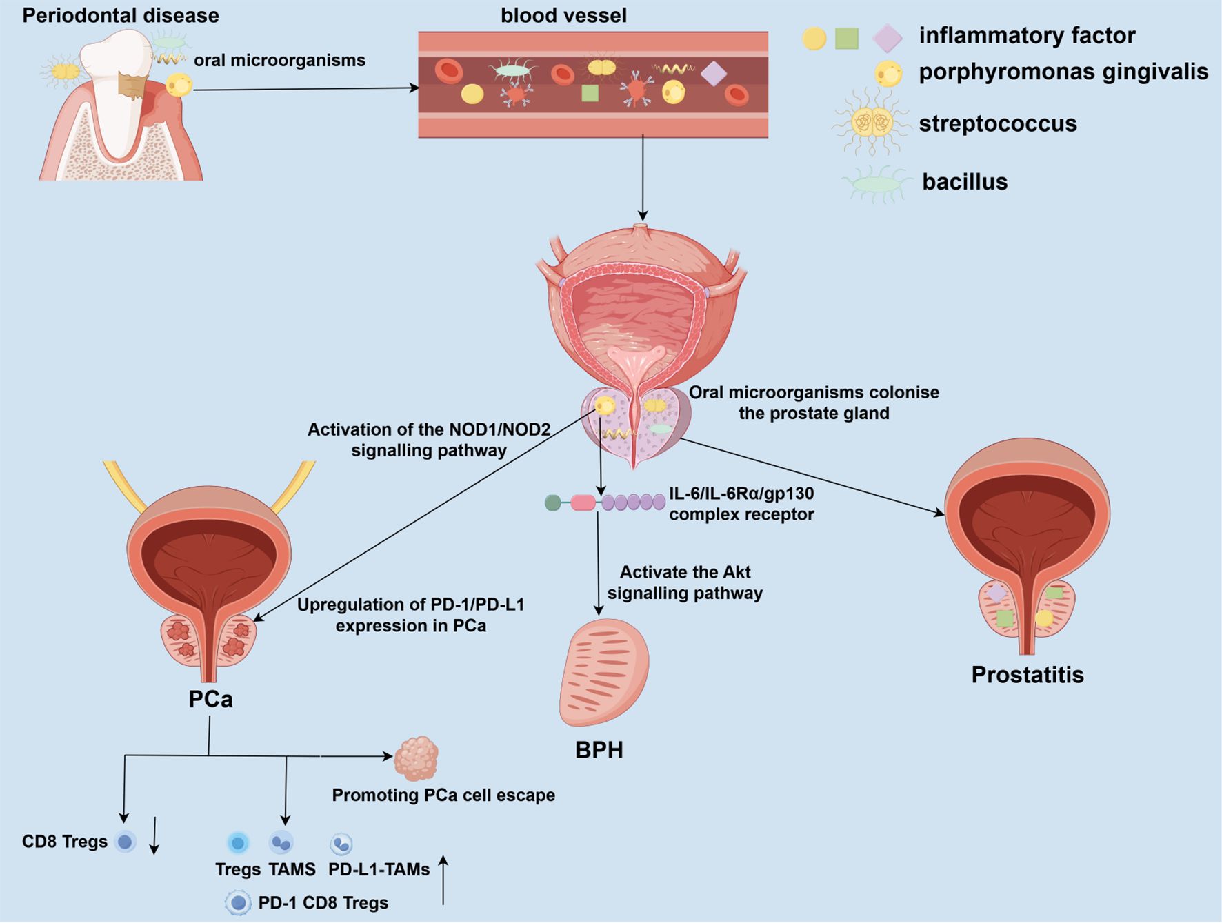 Diagram illustrating the connection between periodontal disease and prostate conditions. Oral microorganisms enter the bloodstream, colonizing the prostate gland. This triggers activation of signaling pathways, leading to prostatitis, benign prostatic hyperplasia (BPH), and prostate cancer (PCa). Inflammatory factors and bacteria like Porphyromonas gingivalis, Streptococcus, and Bacillus are involved. The pathways shown include NOD1/NOD2 and Akt pathways, along with upregulation of PD-1/PD-L1 expression, promoting prostate cancer cell escape. Components such as Tregs, TAMs, and PD-L1-TAMs are also highlighted.
