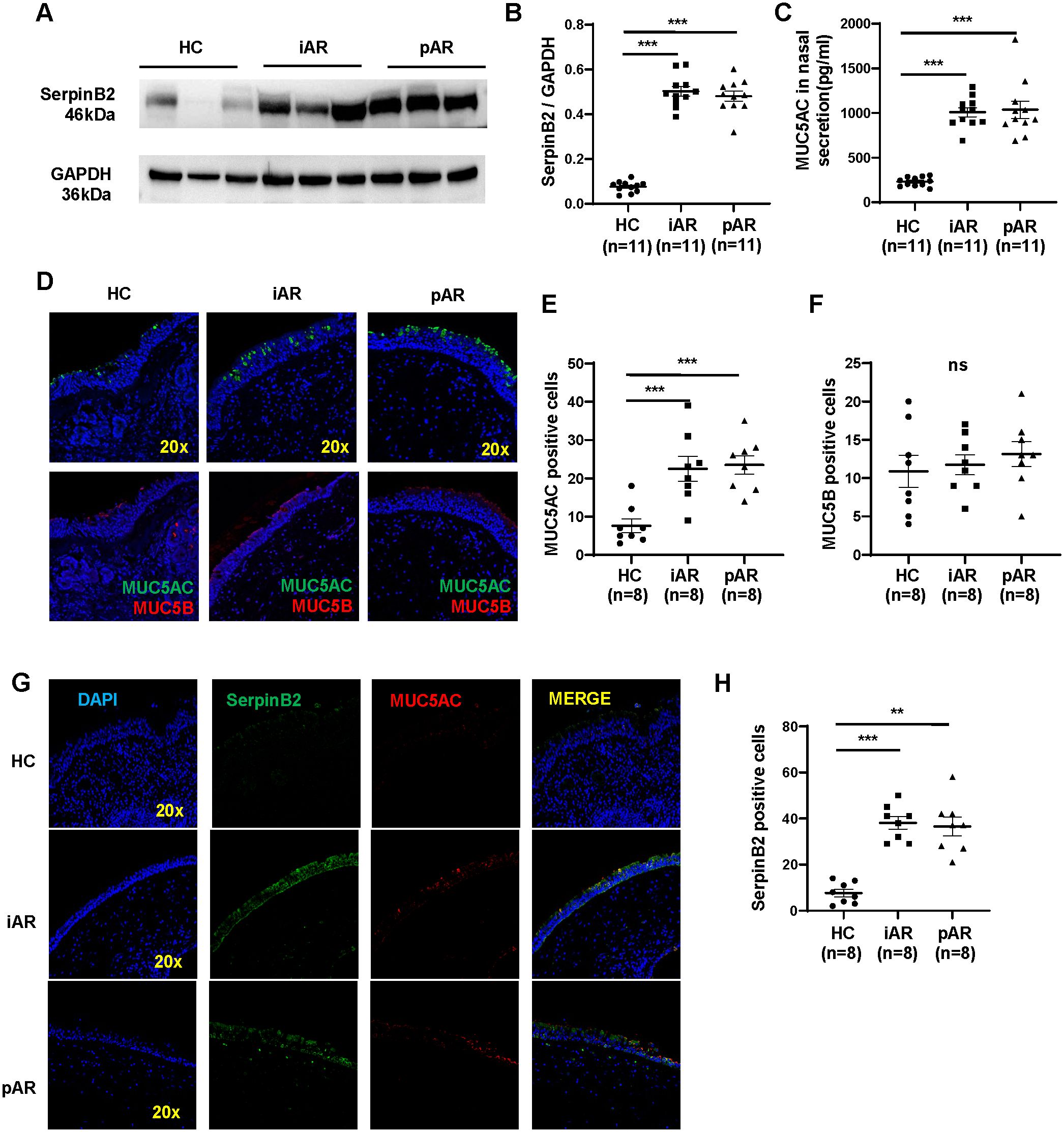 Western blot and immunohistochemistry analysis comparing control, iAR, and pAR groups. Panel A shows protein bands for SerpinB2 and GAPDH. Panels B, C, E, F, and H show graphs with significant differences marked by asterisks. Panel D includes immunofluorescence images showing MUC5AC and MUC5B expression with labels indicating magnification. Panel G presents DAPI, SerpinB2, and MUC5AC staining with merged views. Panels B, C, E, F, and H include sample sizes and statistical annotations.