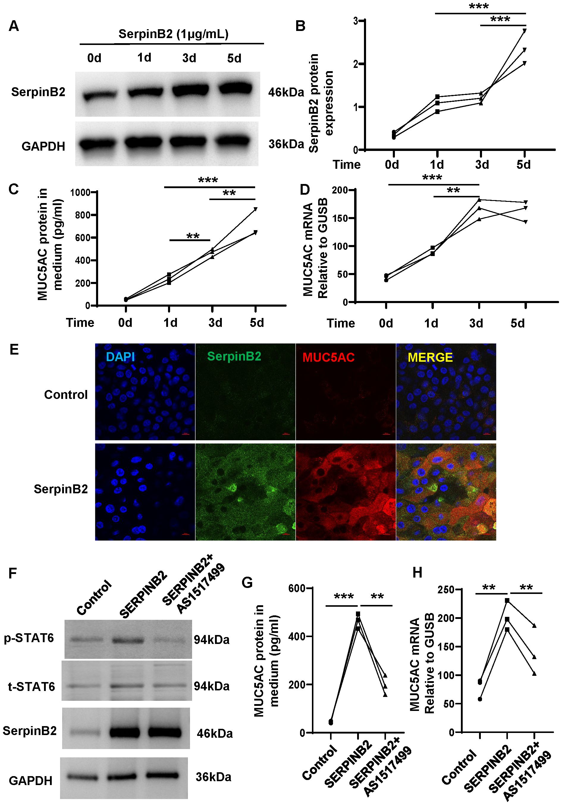 A series of biological experiments showing the effects of SerpinB2 on protein and gene expression. Panel A displays Western blot bands of SerpinB2 and GAPDH across different days. Panels B, C, and D show graphs of SerpinB2 protein expression, MUC5AC protein in medium, and MUC5Ac mRNA relative to GUSB, respectively, over time, with significant changes indicated by asterisks. Panel E includes fluorescent images of cells with DAPI, SerpinB2, and MUC5AC staining. Panel F presents Western blot bands of various proteins in different conditions. Panels G and H display graphs of MUC5AC protein and mRNA levels under different experimental conditions, with significant differences marked.