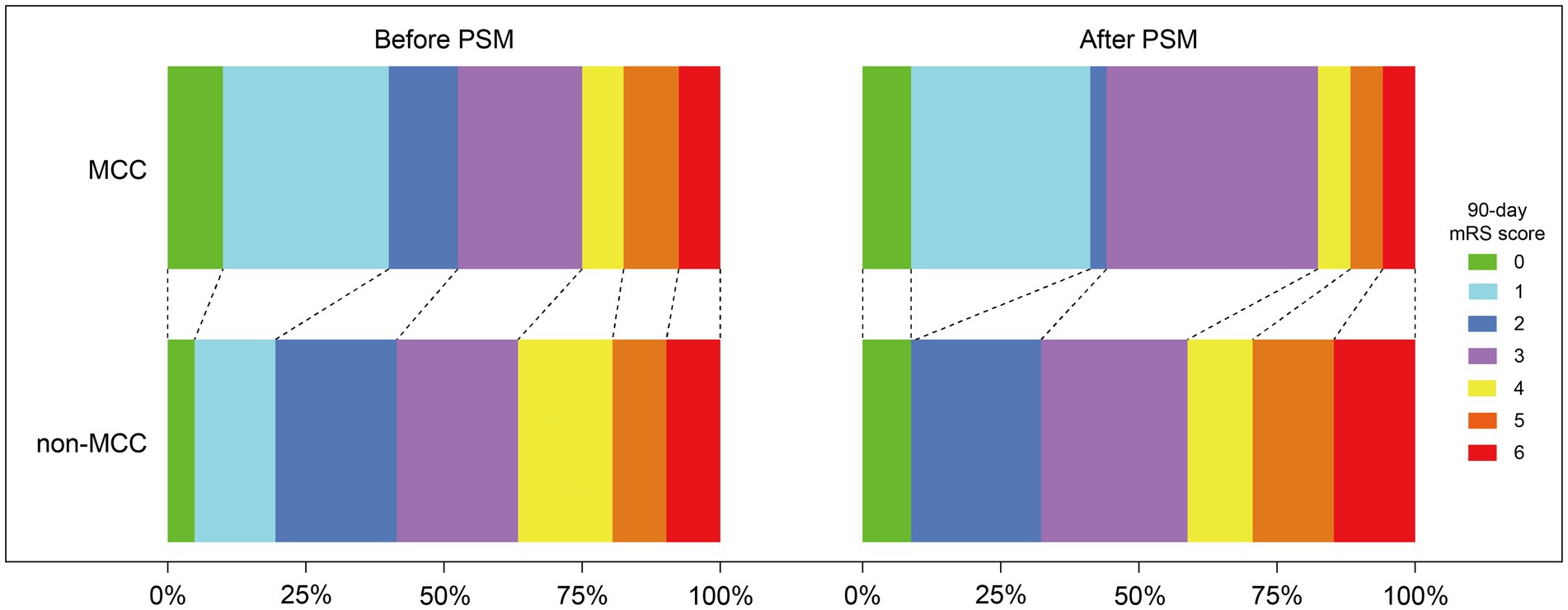 Side-by-side bar charts comparing 90-day mRS scores before and after propensity score matching (PSM) for MCC and non-MCC groups. The left chart shows more diversity in scores, while the right chart, after PSM, shows a shift with more individuals in higher score categories. Colors represent scores from zero to six.