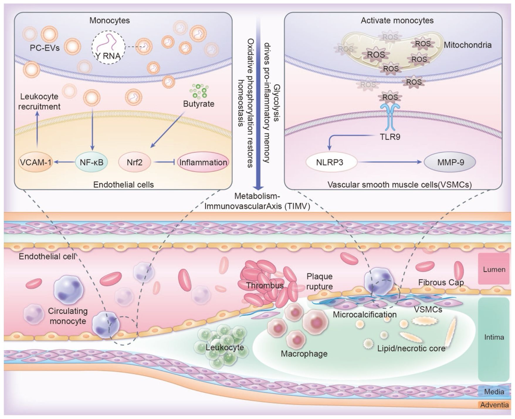 Diagram of vascular biology showing two main sections. The top part illustrates interactions between endothelial cells, monocytes, and butyrate influencing inflammation via VCAM-1, NF-kB, and Nrf2. It also highlights how glycolysis drives pro-inflammatory memory with a focus on TLR9 and mitochondria-related ROS in activated monocytes. The bottom part depicts vascular layers with endothelial cells, monocytes, leukocytes, and VSMCs, showing pathophysiological changes like plaque rupture, thrombosis, microcalcification, and lipid core formation. Both parts are interconnected by the metabolism-immunovascular axis (TIMV).