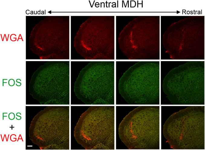 Fluorescent micrographs show sections of the ventral medullary dorsal horn (MDH) in a grid of three rows and four columns. The first row highlights red-stained WGA, the second green-stained FOS, and the third a combined overlay of WGA and FOS, illustrating a blend of red and green fluorescence. The sequence goes from caudal to rostral sections.