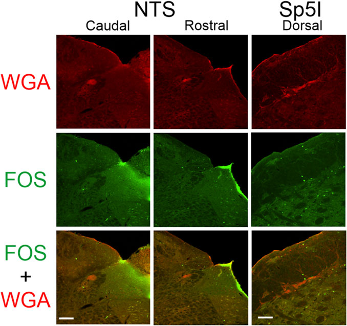 Fluorescent microscopy images showing three rows and three columns. The first row depicts red-stained WGA in the caudal, rostral, and dorsal sections. The first row depicts red-stained WGA in the caudal and rostral nucleus tractus solitarius (NTS), and dorsal spinal trigeminal nucleus interpolaris (Sp5I).