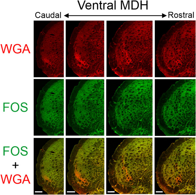 Three rows of fluorescent images display sections of the ventral medullary dorsal horn (MDH), viewed caudally to rostrally. The top row shows WGA labeling in red, the middle row shows FOS labeling in green, and the bottom row displays a merged image of both WGA and FOS, highlighting overlapping areas in yellow. Scale bars are present at the bottom of each image for reference.