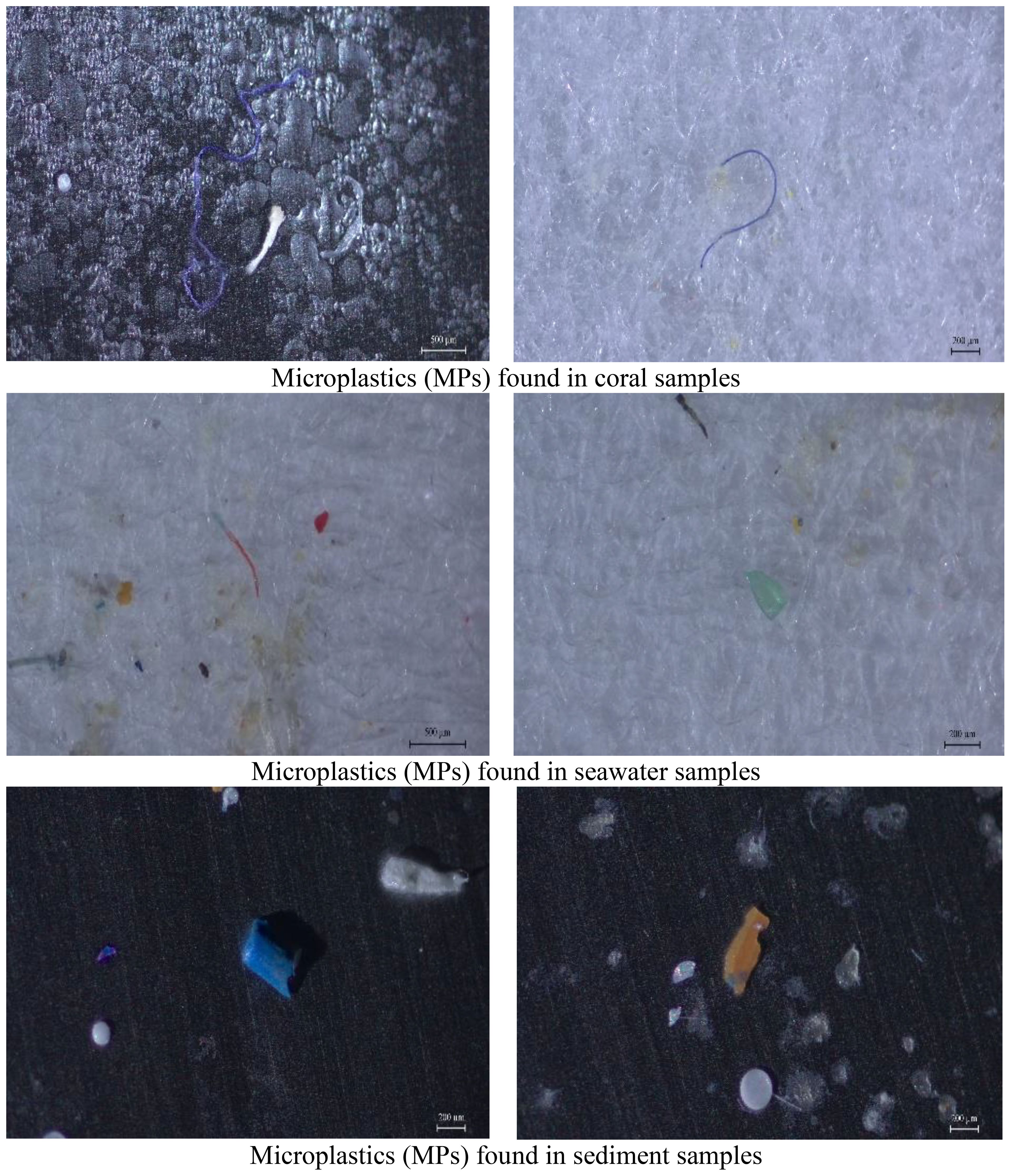 Microscopic images show microplastics in various samples. The top row displays blue and white microplastics in coral samples. The middle row shows small colored fragments in seawater samples. The bottom row includes blue, white, and orange microplastics in sediment samples, illustrating the diversity of microplastic pollution across different environments.