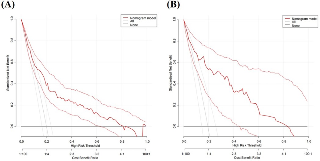 Two line graphs labeled A and B depict standardized net benefit against high-risk threshold. Both graphs compare three curves: Nomogram model (red), All (gray), and None (gray). The x-axis shows high-risk threshold and cost-benefit ratio, while the y-axis shows standardized net benefit ranging from zero to one. The Nomogram model in both graphs indicates higher net benefit across the threshold compared to All and None.