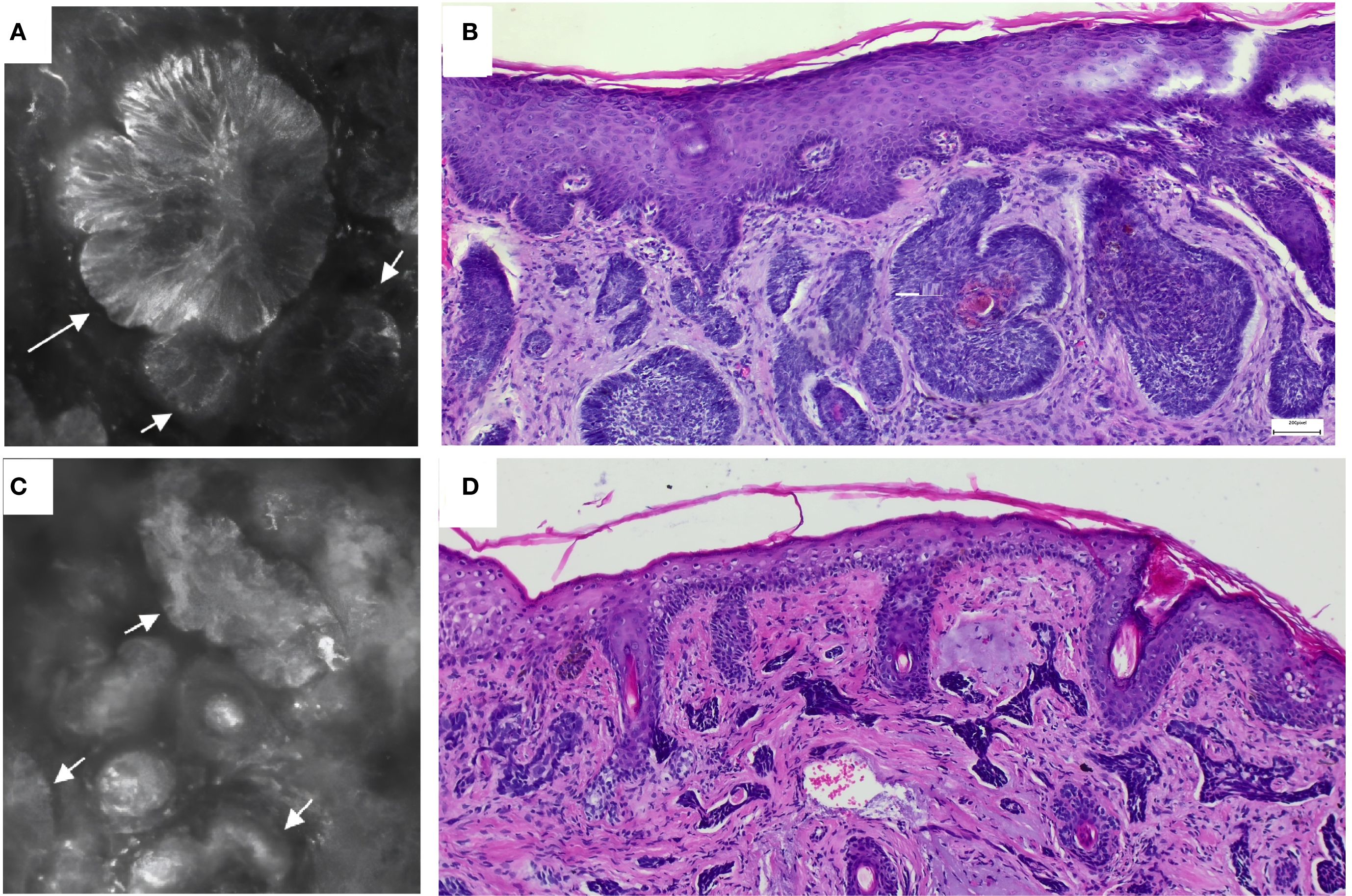 Panel A and C show black-and-white microscopic images of skin tissue with arrows pointing to specific regions of interest, highlighting structure and texture. Panel B and D display colored histological sections of skin tissue in purples and pinks, indicating cellular and tissue details, with an emphasis on layered organization and texture. Each panel focuses on different aspects of tissue morphology.