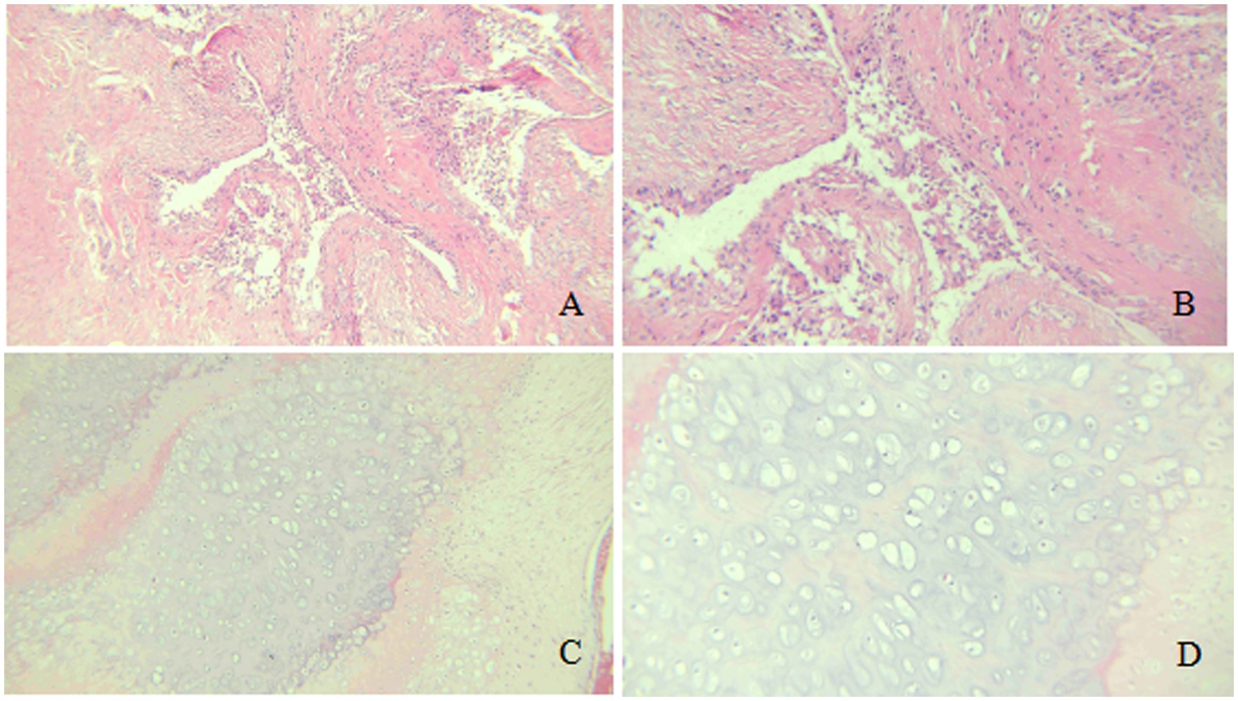 Histological images showing four slides labeled A, B, C, and D. Images A and B display dense, irregular clusters of cells with pink and white staining. Images C and D reveal more defined, circular structures with lighter pink tones. Each panel illustrates different tissue characteristics.