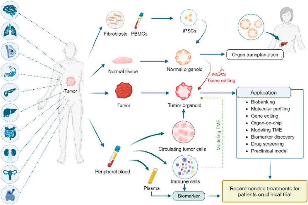 Diagram illustrating a medical process starting from tumor extraction and leading to potential treatments. It involves fibroblasts, PBMCs, iPSCs, normal and tumor tissues, organoids, and gene editing. Applications include biobanking, molecular profiling, and biomarker discovery, ultimately guiding recommended treatments for patients in clinical trials. Various organs are depicted on the left, connected to the central figure with a tumor.