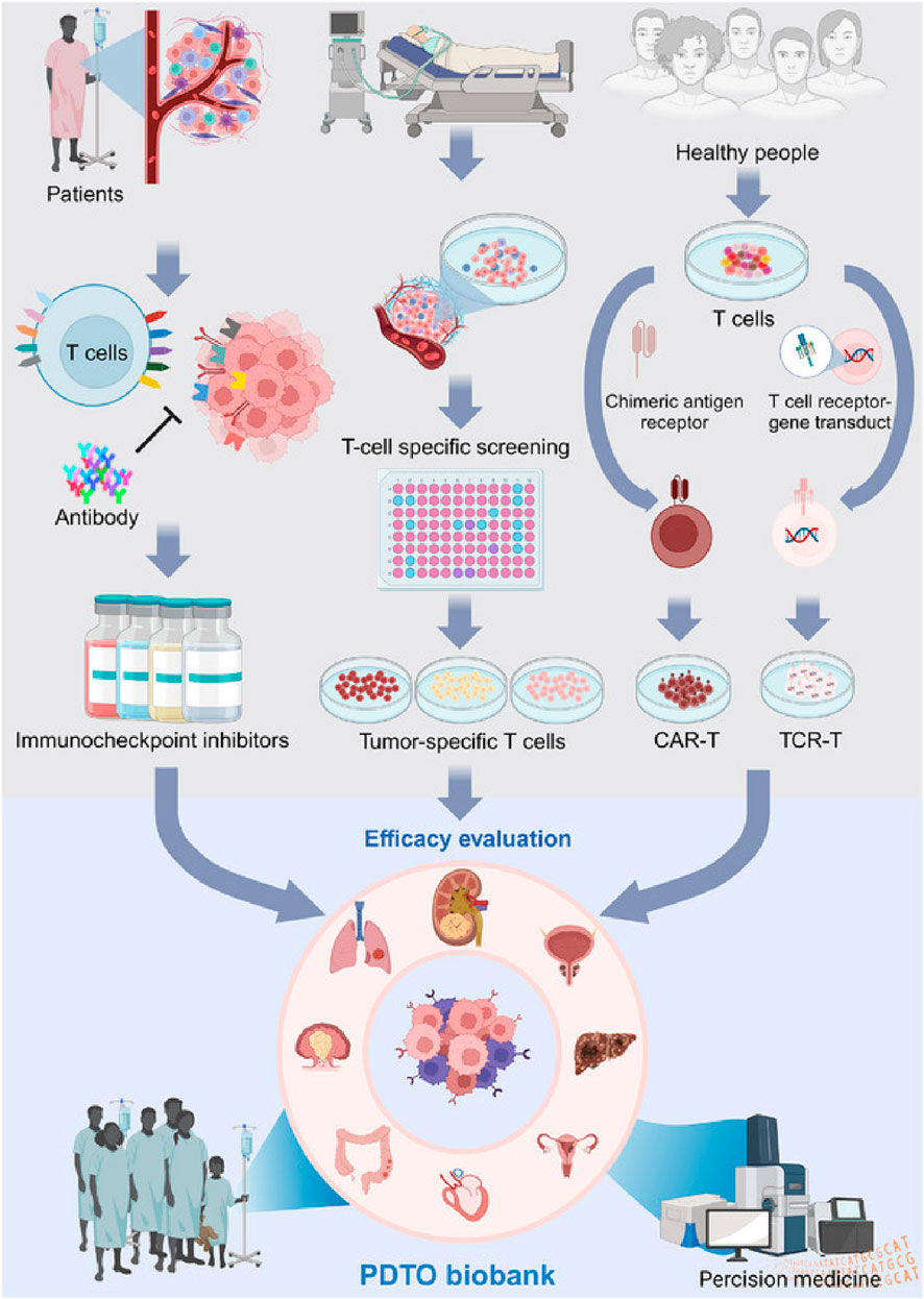 Flowchart illustrating a biobank process for precision medicine, starting with patients and healthy people. T cells are screened, modified, and classified into tumor-specific, CAR-T, and TCR-T cells. Immunocheckpoint inhibitors form one outcome. These elements undergo efficacy evaluation, integrating into a PDO biobank for various organs, and are used in precision medicine research.