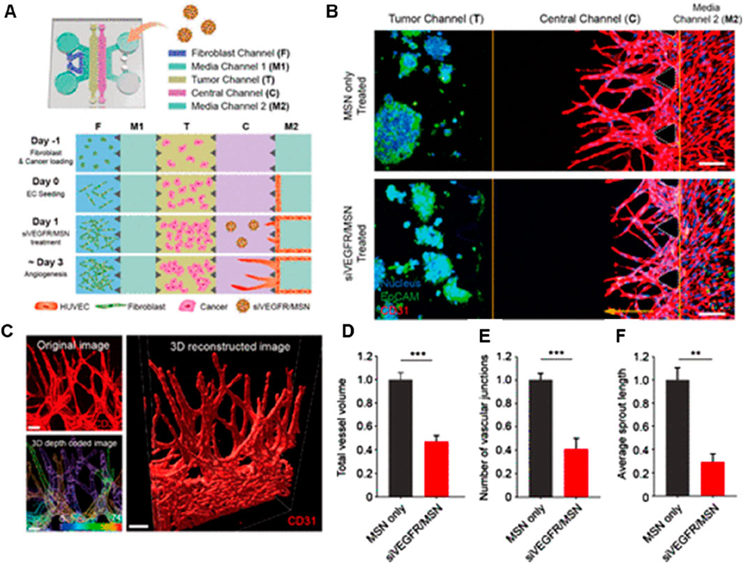 Diagram depicting a study on angiogenesis. Part A illustrates a schematic of five channels for fibroblasts, media, tumors, and central processes across several days, showing cell loading and treatment. Part B compares tumor and media channels under MSN only and sVEGFR/MSN treatments, highlighting cellular differences. Part C shows original and 3D-reconstructed images of vascular structures, with coloring for depth. Graphs D, E, and F display bar charts indicating reductions in total vessel volume, number of vascular junctions, and average sprout length when treated with sVEGFR/MSN compared to MSN only.