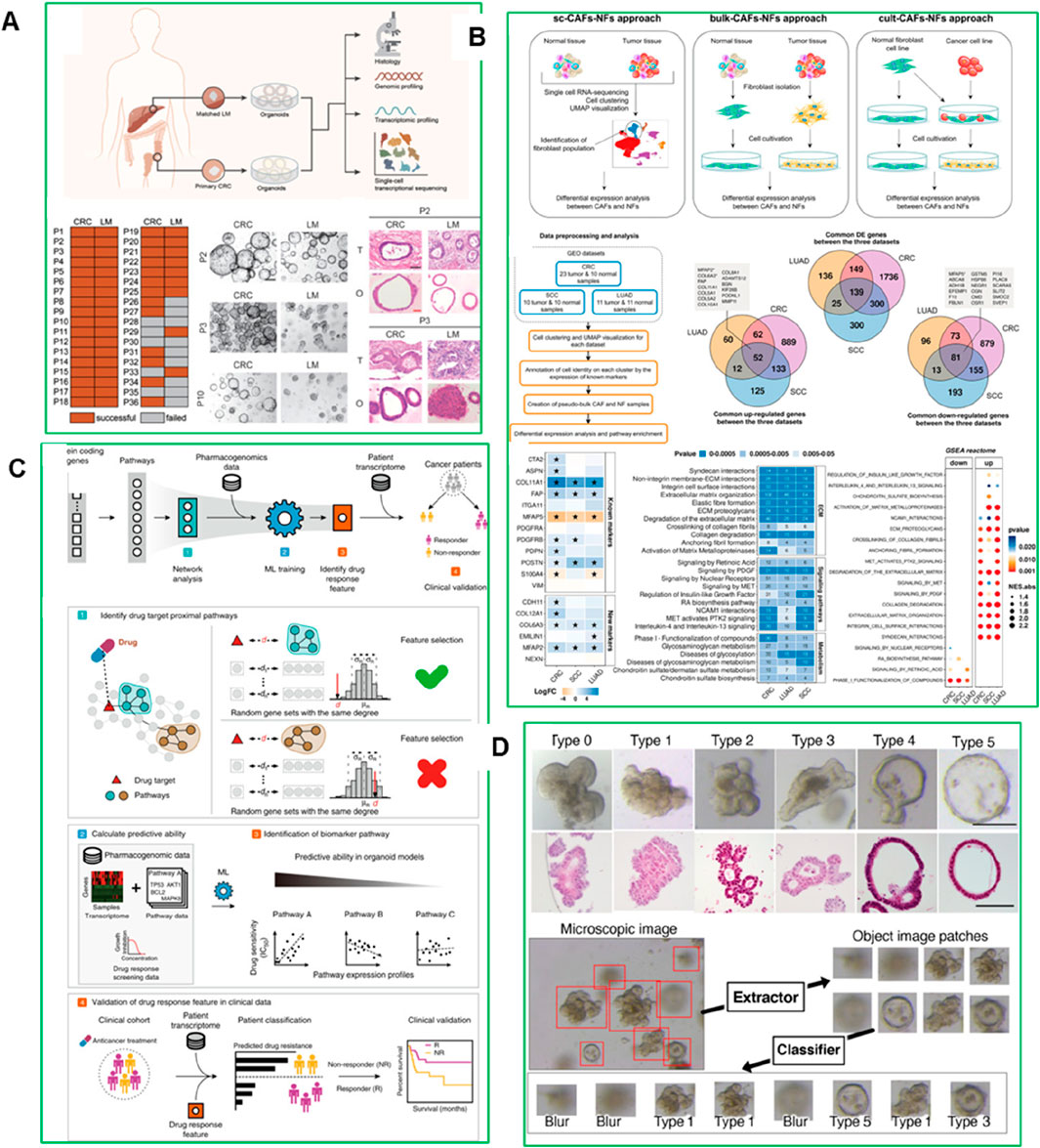 Scientific infographic divided into panels A, B, C, and D with illustrations, charts, and diagrams. Panel A shows a process of sample extraction and analysis of liver metastasis and colorectal cancer, including images of tissues and organoids. Panel B details various experimental approaches involving sc-CAFs/NFs, bulk-CAFs/NFs, and cult-CAFs/NFs with diagrams and Venn diagrams summarizing data processing, showing differentially expressed genes for lung adenocarcinoma and colorectal cancer. Panel C outlines a predictive model for drug response using machine learning and network analysis, with a focus on pharmacogenomics and patient profiling. Panel D demonstrates image classification of tissue samples with examples of microscopic images and categorization into different types.
