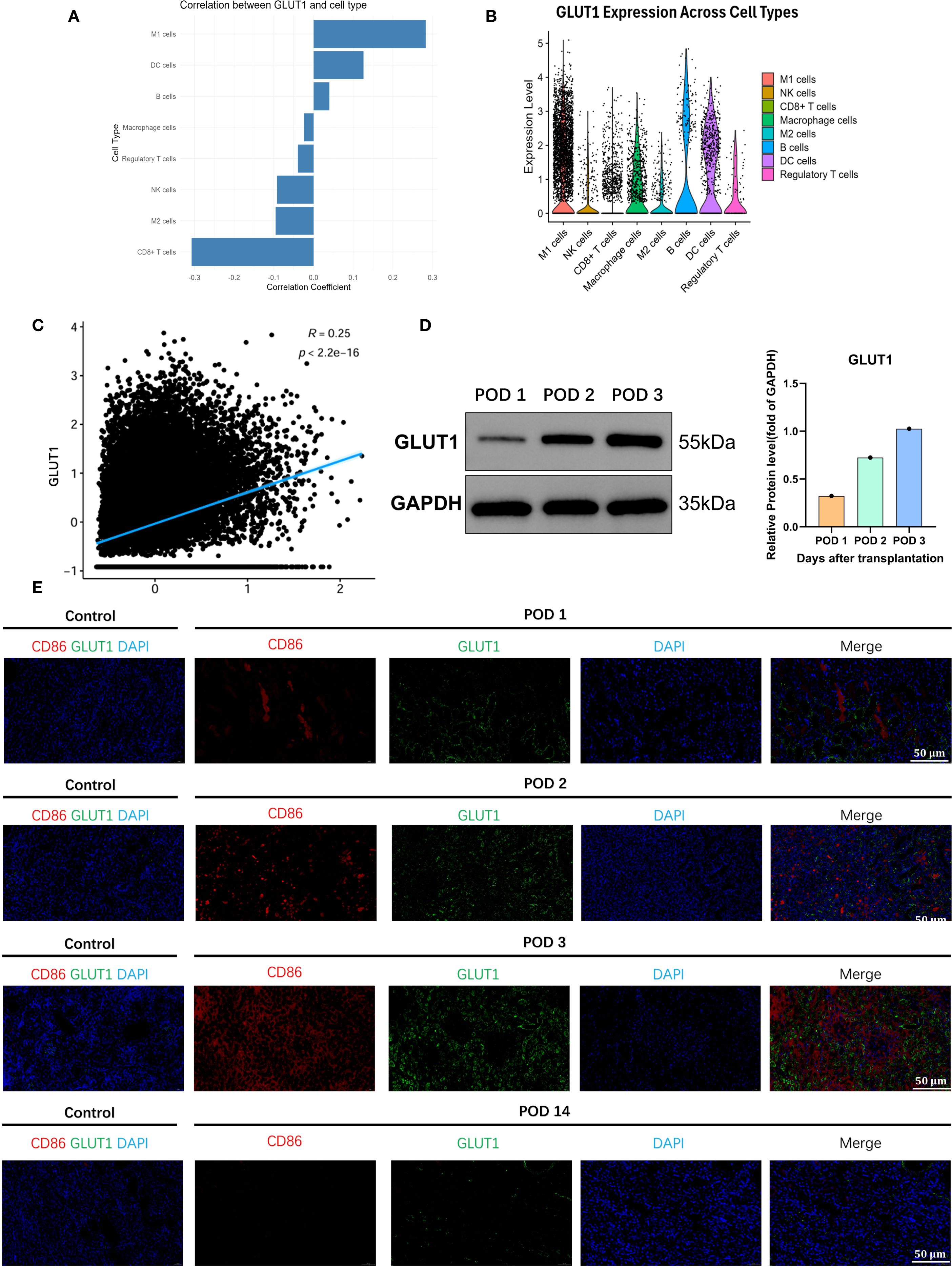 The image consists of multiple panels depicting statistical data and scientific analyses related to GLUT1 expression across different cell types. Panel A shows a bar graph of correlation coefficients between GLUT1 and various cell types. Panel B presents a violin plot of GLUT1 expression levels across these cell types. Panel C features a scatter plot correlating certain variables, with a line showing R = 0.25 and p < 2.2e-16. Panel D displays Western blot results of GLUT1 and GAPDH, with a bar chart indicating relative protein levels over days following transplantation. Panel E includes microscopic images showing CD86 and GLUT1 staining across different post-operative days compared with control.