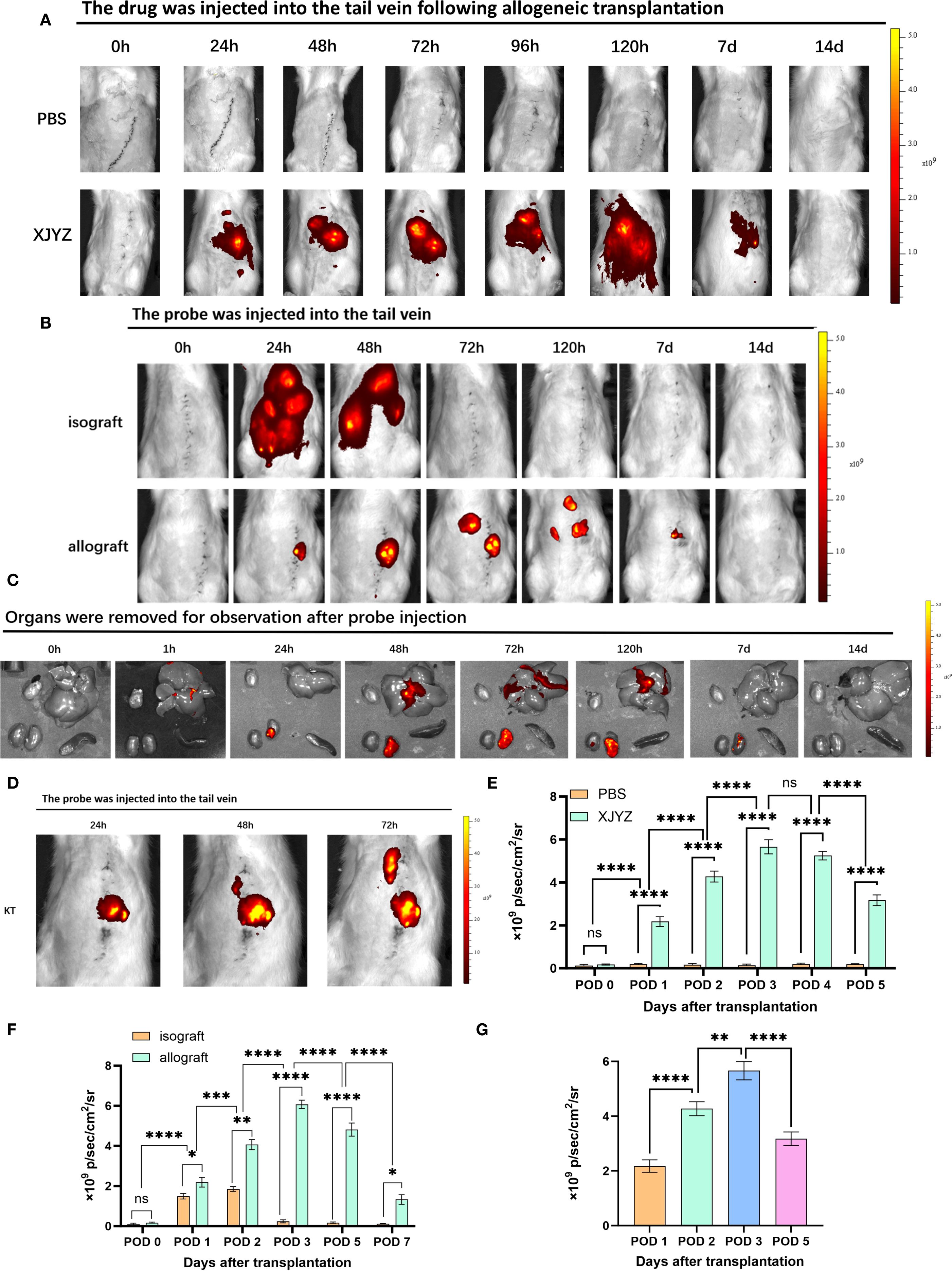 Panel of scientific images displaying experimental results. Panels A, B, and D show in vivo imaging of mice after drug injection, highlighting different time points demonstrating changes in fluorescence intensity. Panel C presents ex vivo organ images post-probe injection. Panels E, F, and G are bar graphs illustrating quantitative fluorescence measurements over time, comparing PBS, XJYZ, isograft, and allograft groups. Statistical significance is denoted by asterisks, indicating differences in fluorescence intensity across various days post-transplantation. Each section uses a color scale to represent intensity levels.