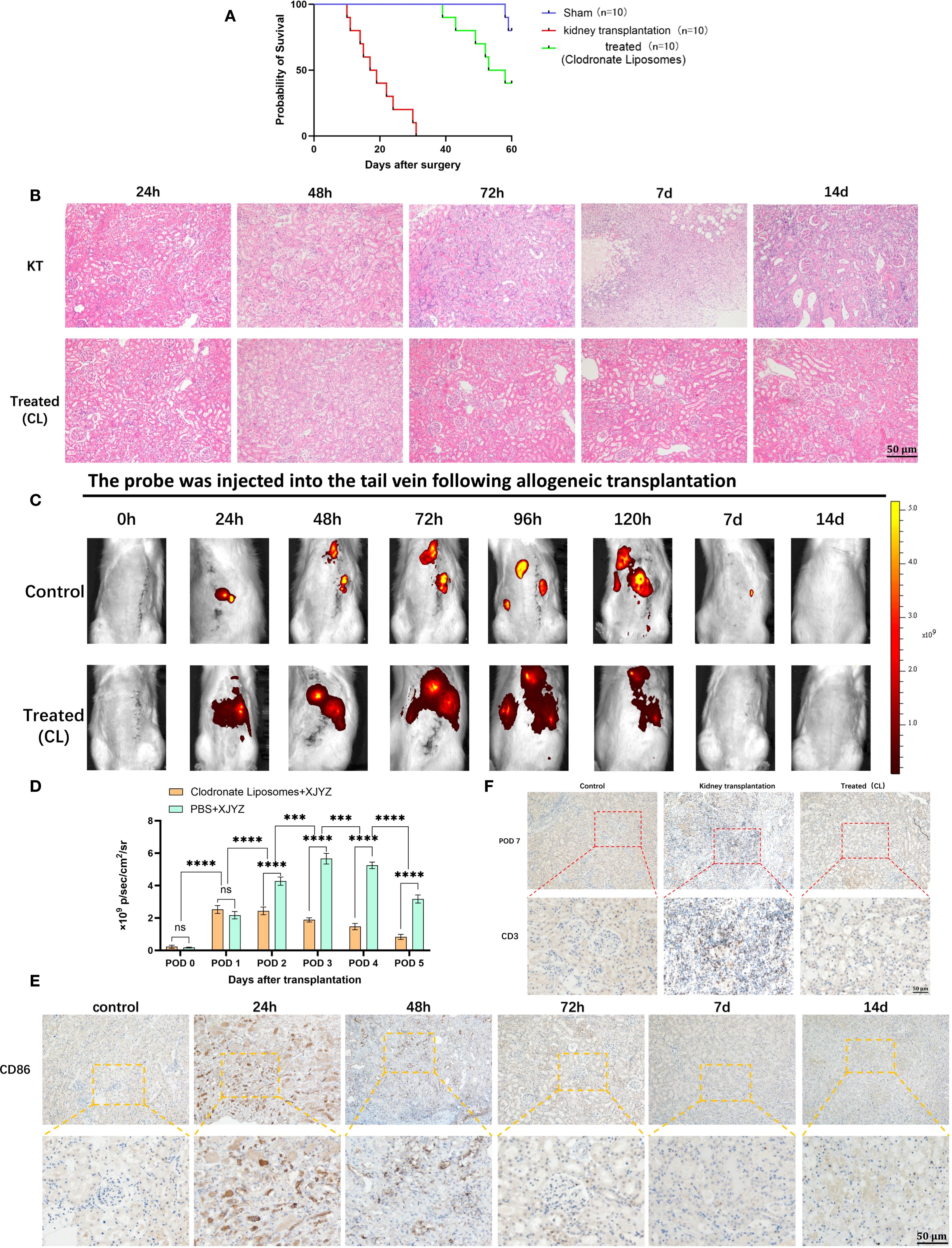 A multi-panel image featuring various studies related to kidney transplantation and treatment with clodronate liposomes.  A: Kaplan-Meier survival curves show different survival probabilities post-surgery for sham, kidney transplantation, and treated groups. B: Histological images of kidney sections at different time points (24 hours to 14 days) for kidney transplantation and treated groups. C: In vivo imaging showing probe distribution over various time points (0 to 14 days) for control and treated groups. D: Bar graph depicting β-value changes over days 0 to 5 post-transplantation for treatments using clodronate liposomes and PBS. E: CD86 expression images at various times after transplantation, with control and progressively detailed insets. F: CD3 immunostaining on day 7 post-transplantation comparing control, kidney transplantation, and treated groups using clodronate liposomes.