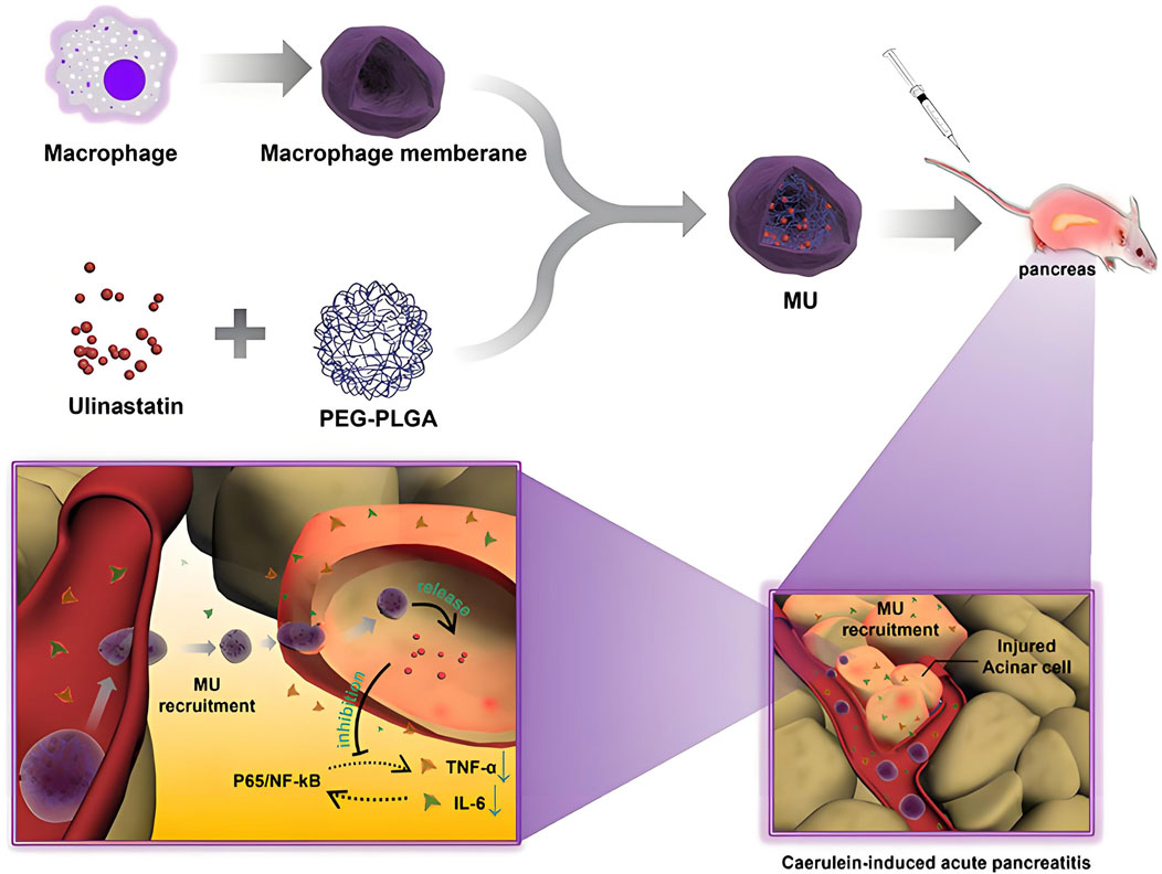 Diagram illustrating the process of using macrophage membranes to create MU for targeting the pancreas in a mouse model of caerulein-induced acute pancreatitis. Components include ulinastatin, PEG-PLGA, and macrophage membranes. Insets show MU recruitment, inhibition of P65/NF-kB, TNF-alpha, and IL-6 release, and highlight injured acinar cells.