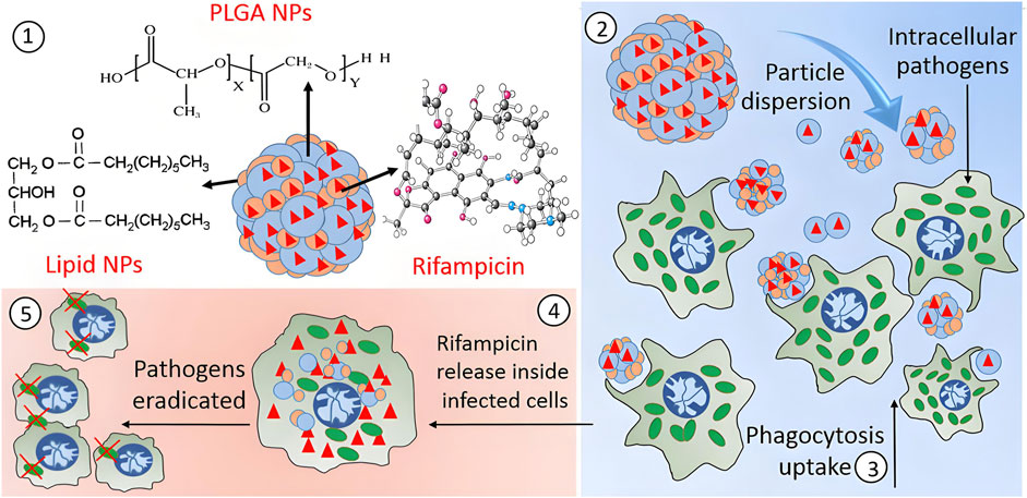 Diagram illustrating the process of nanoparticle-based drug delivery. Panel 1 shows PLGA and lipid nanoparticles encapsulating rifampicin. Panel 2 illustrates the dispersion of these particles and their interaction with cells containing intracellular pathogens. Panel 3 describes phagocytosis uptake by the cells. Panel 4 shows the release of rifampicin inside infected cells. Panel 5 depicts eradication of pathogens, indicated by red crosses on infected cells.